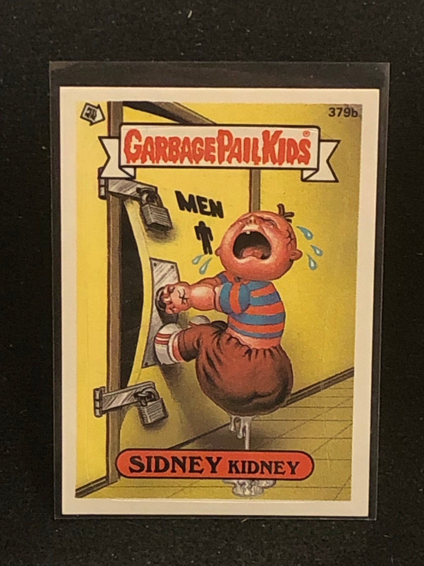Garbage Pail Kids Original Series 10 (os10) 379b Sidney Kidney