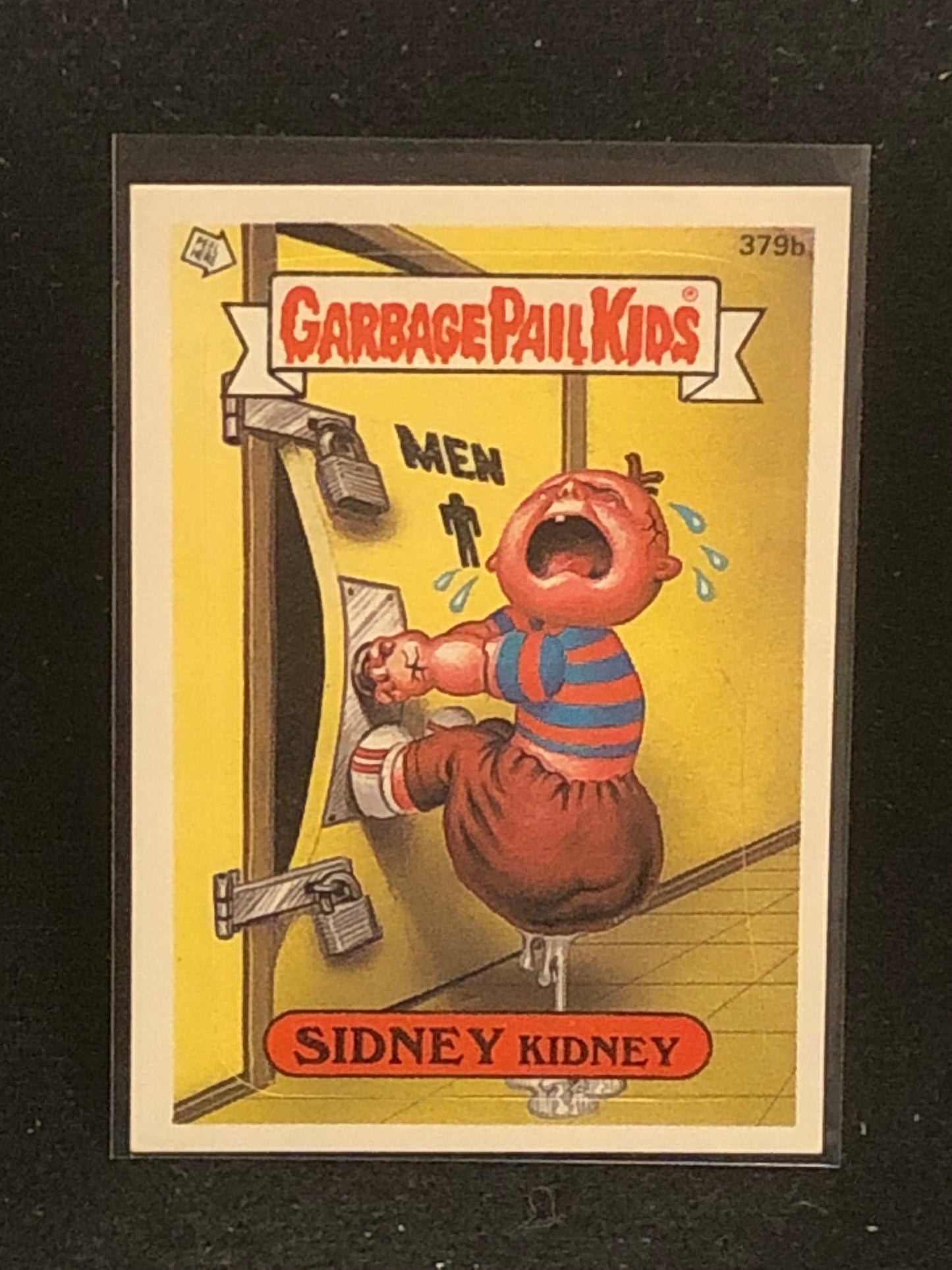Garbage Pail Kids Original Series 10 (os10) 379b Sidney Kidney