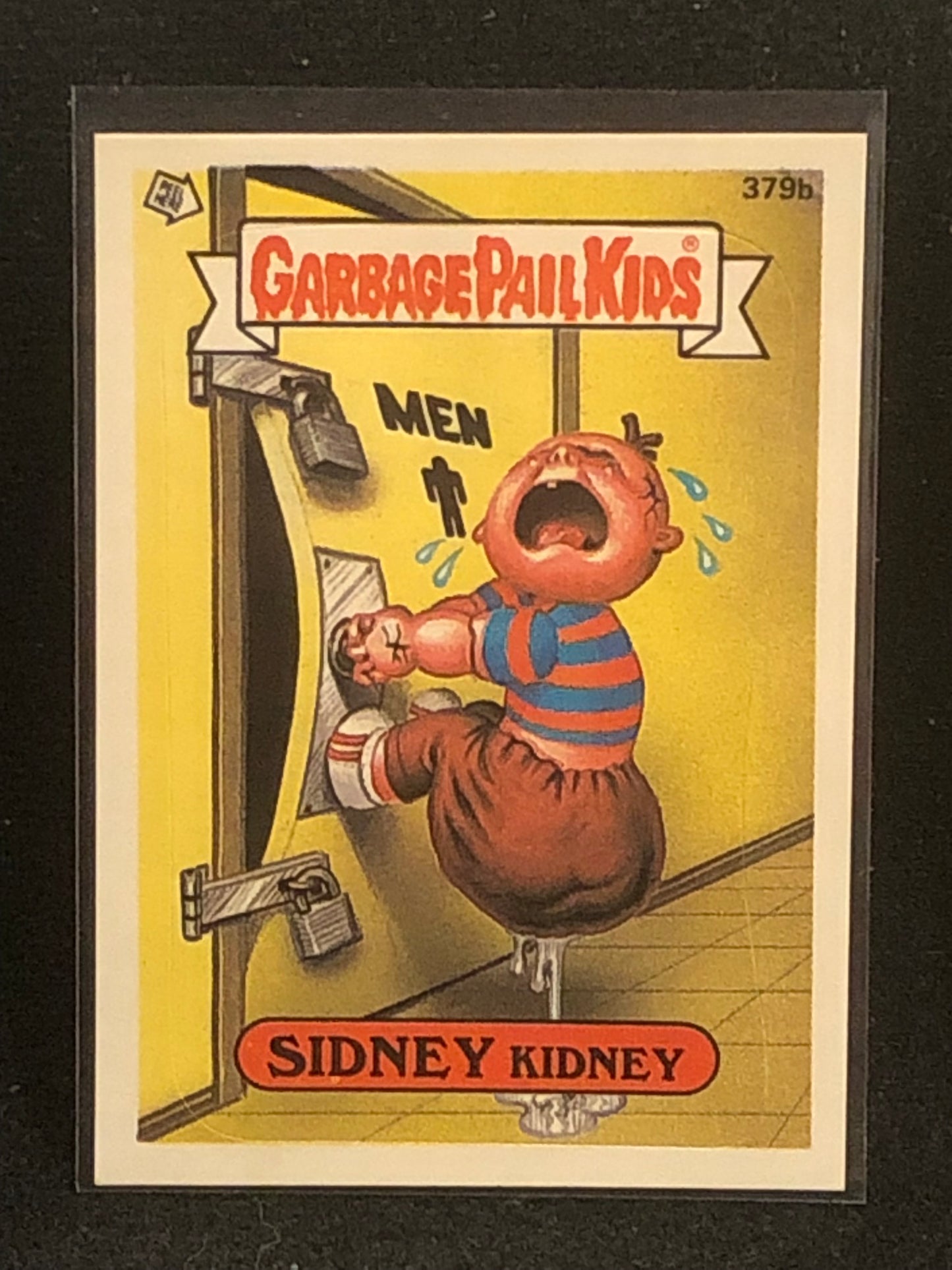 Garbage Pail Kids Original Series 10 (os10) 379b Sidney Kidney