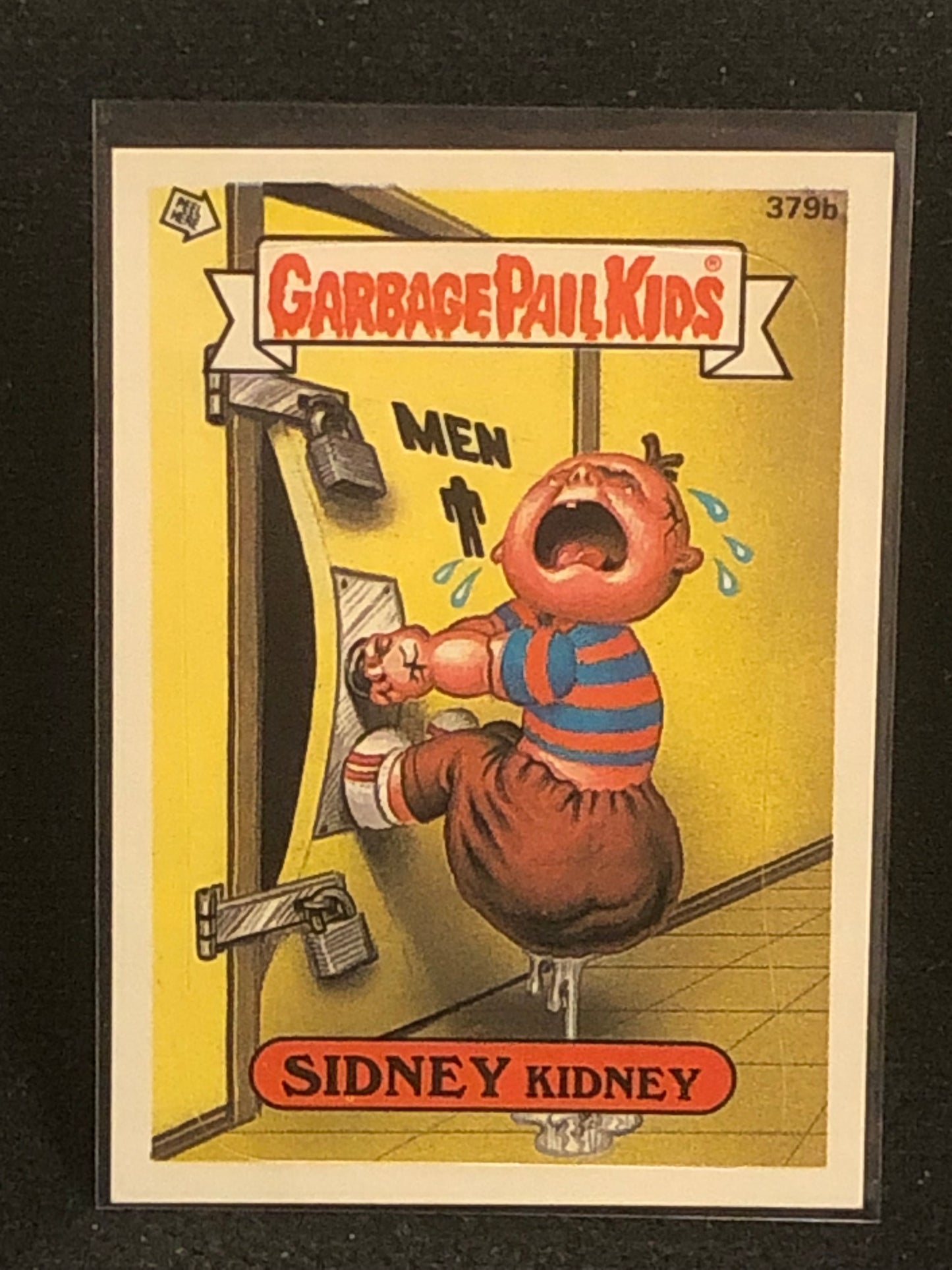 Garbage Pail Kids Original Series 10 (os10) 379b Sidney Kidney
