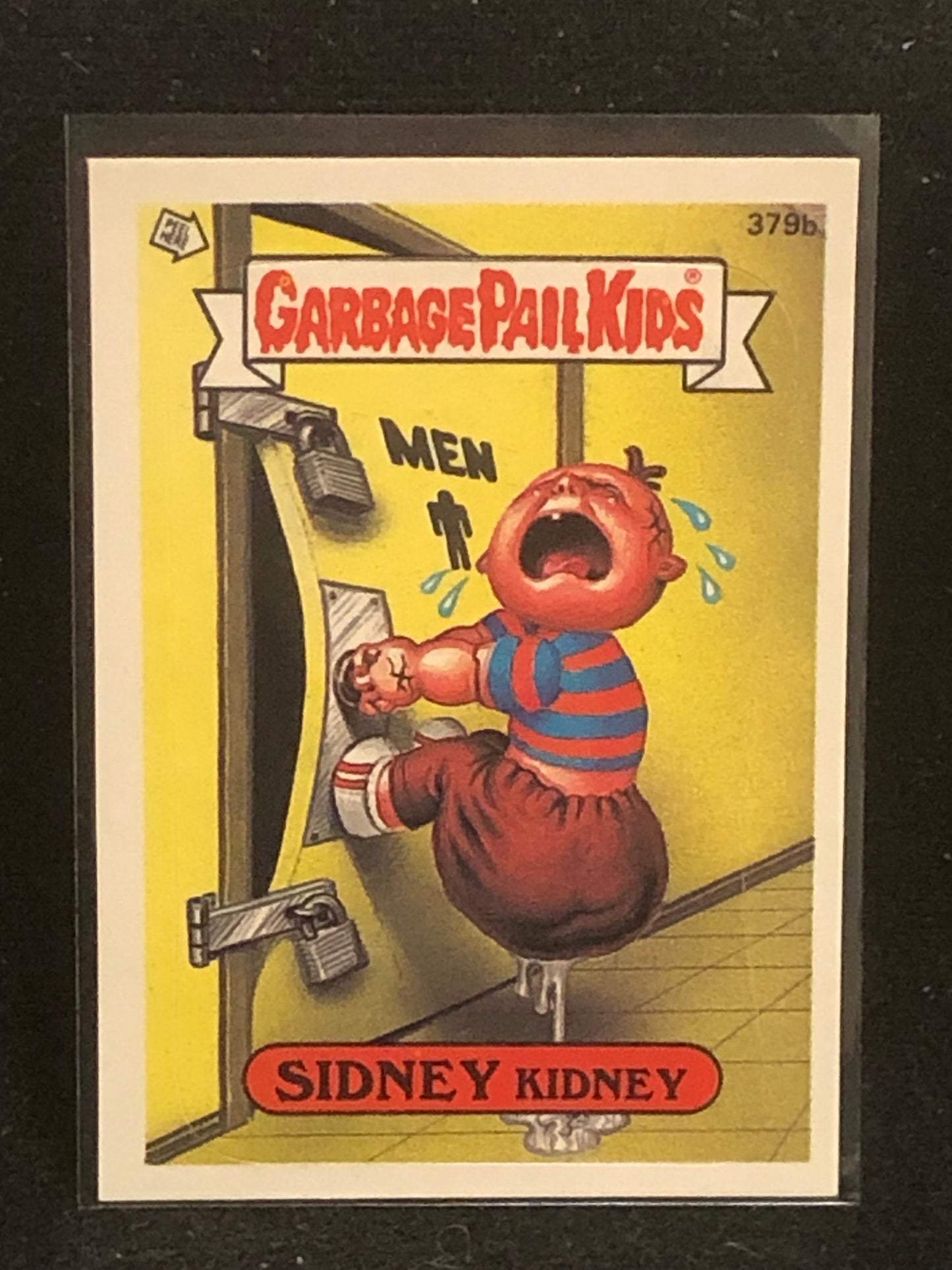 Garbage Pail Kids Original Series 10 (os10) 379b Sidney Kidney