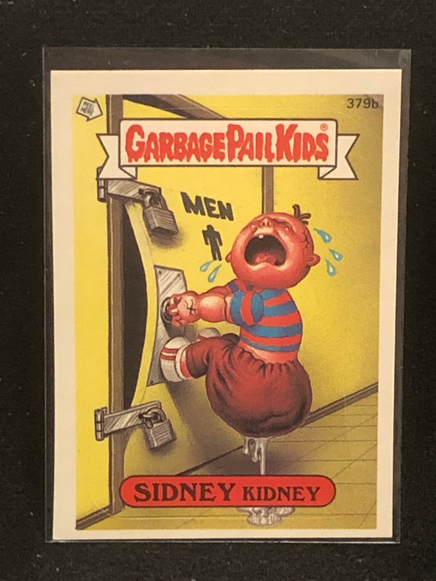 Garbage Pail Kids Original Series 10 (os10) 379b Sidney Kidney