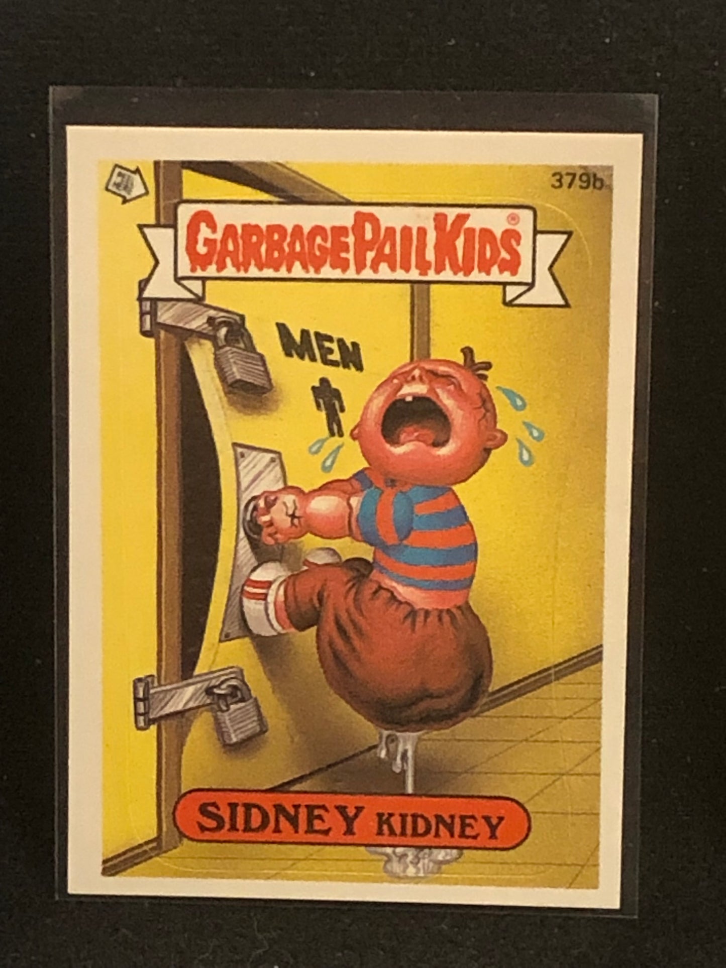 Garbage Pail Kids Original Series 10 (os10) 379b Sidney Kidney