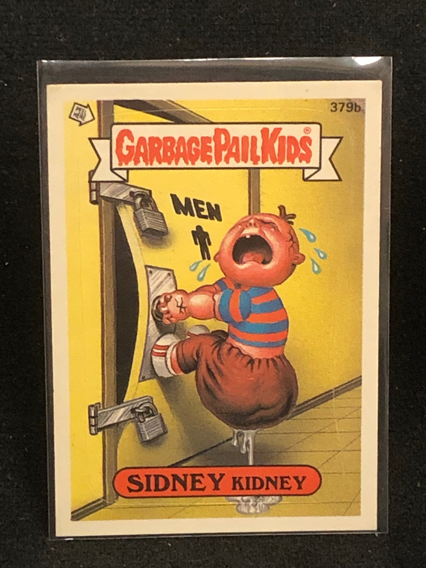 Garbage Pail Kids Original Series 10 (os10) 379b Sidney Kidney