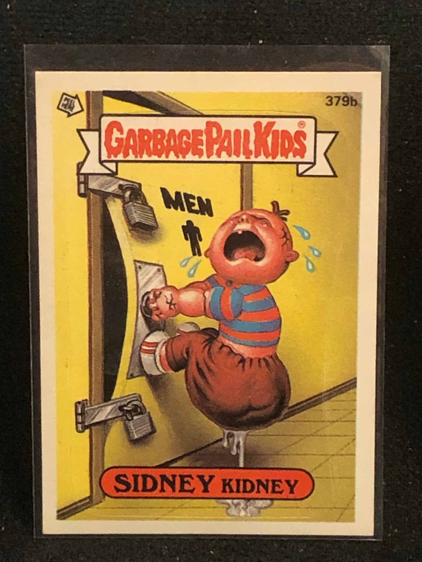 Garbage Pail Kids Original Series 10 (os10) 379b Sidney Kidney