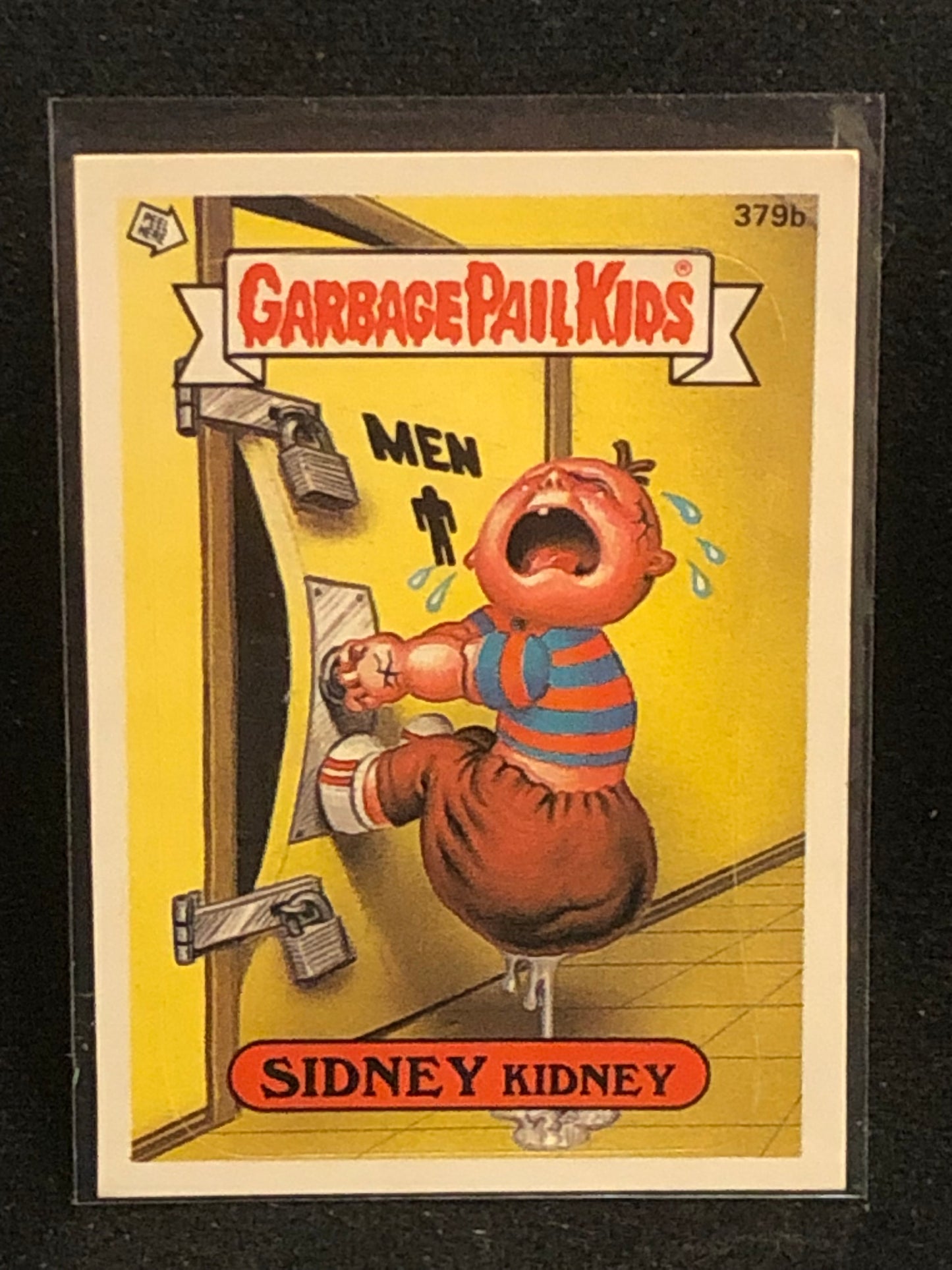 Garbage Pail Kids Original Series 10 (os10) 379b Sidney Kidney
