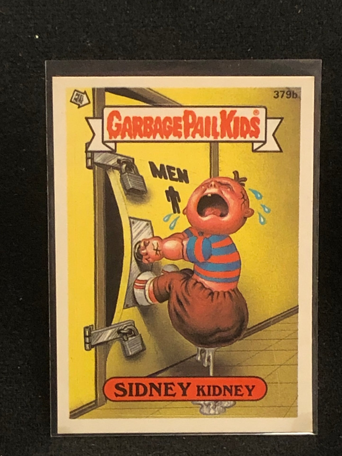 Garbage Pail Kids Original Series 10 (os10) 379b Sidney Kidney