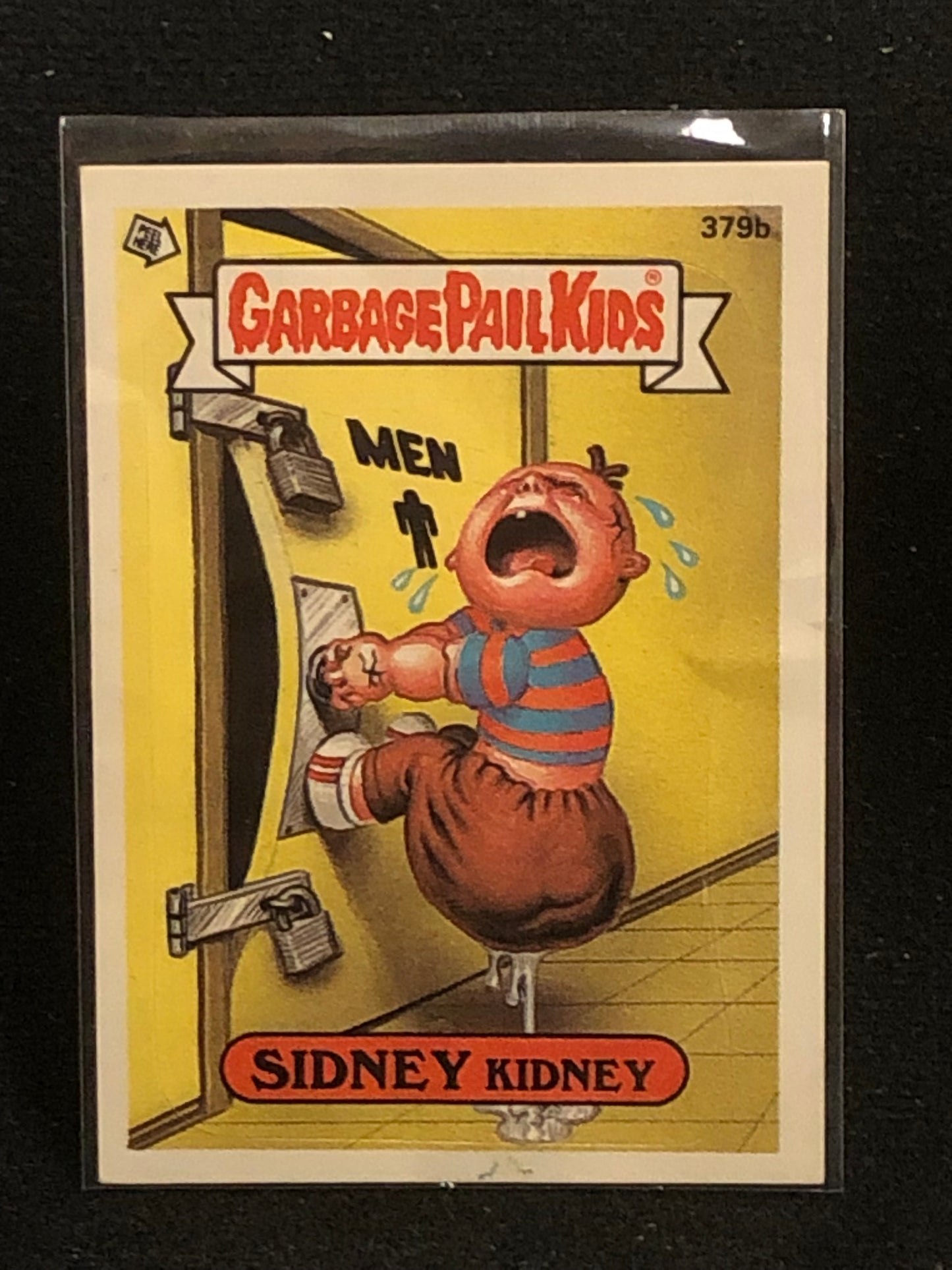 Garbage Pail Kids Original Series 10 (os10) 379b Sidney Kidney