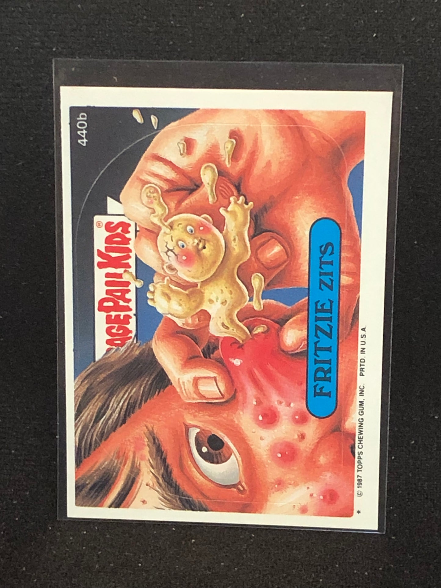 Garbage Pail Kids Original Series 11 (os11) 440b Fritzie Zits