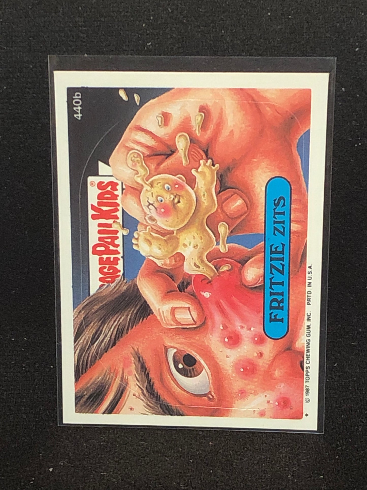 Garbage Pail Kids Original Series 11 (os11) 440b Fritzie Zits