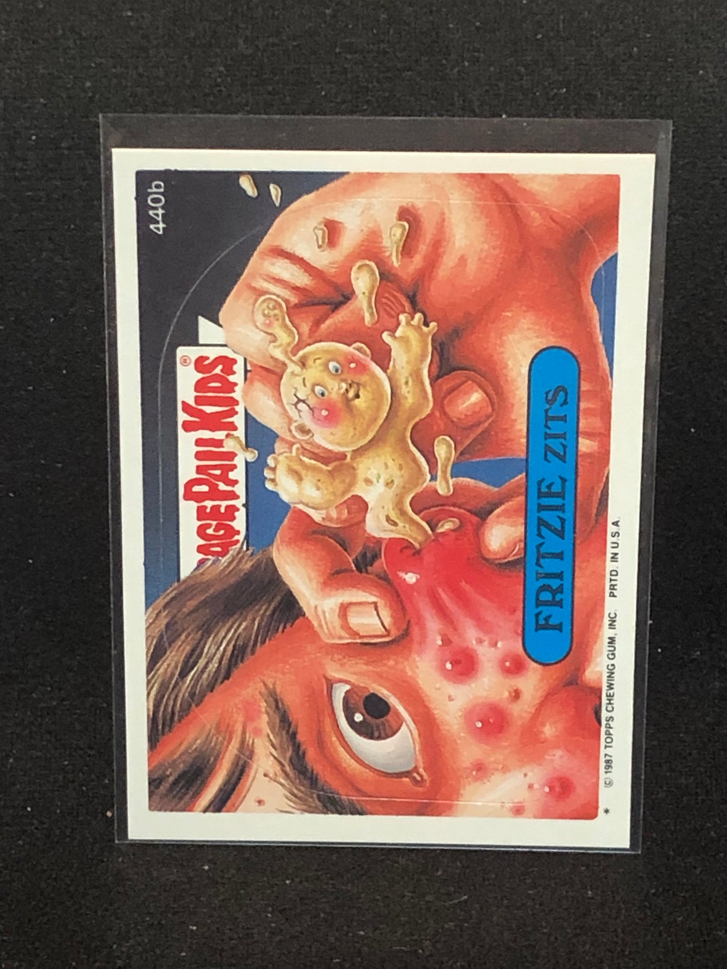 Garbage Pail Kids Original Series 11 (os11) 440b Fritzie Zits