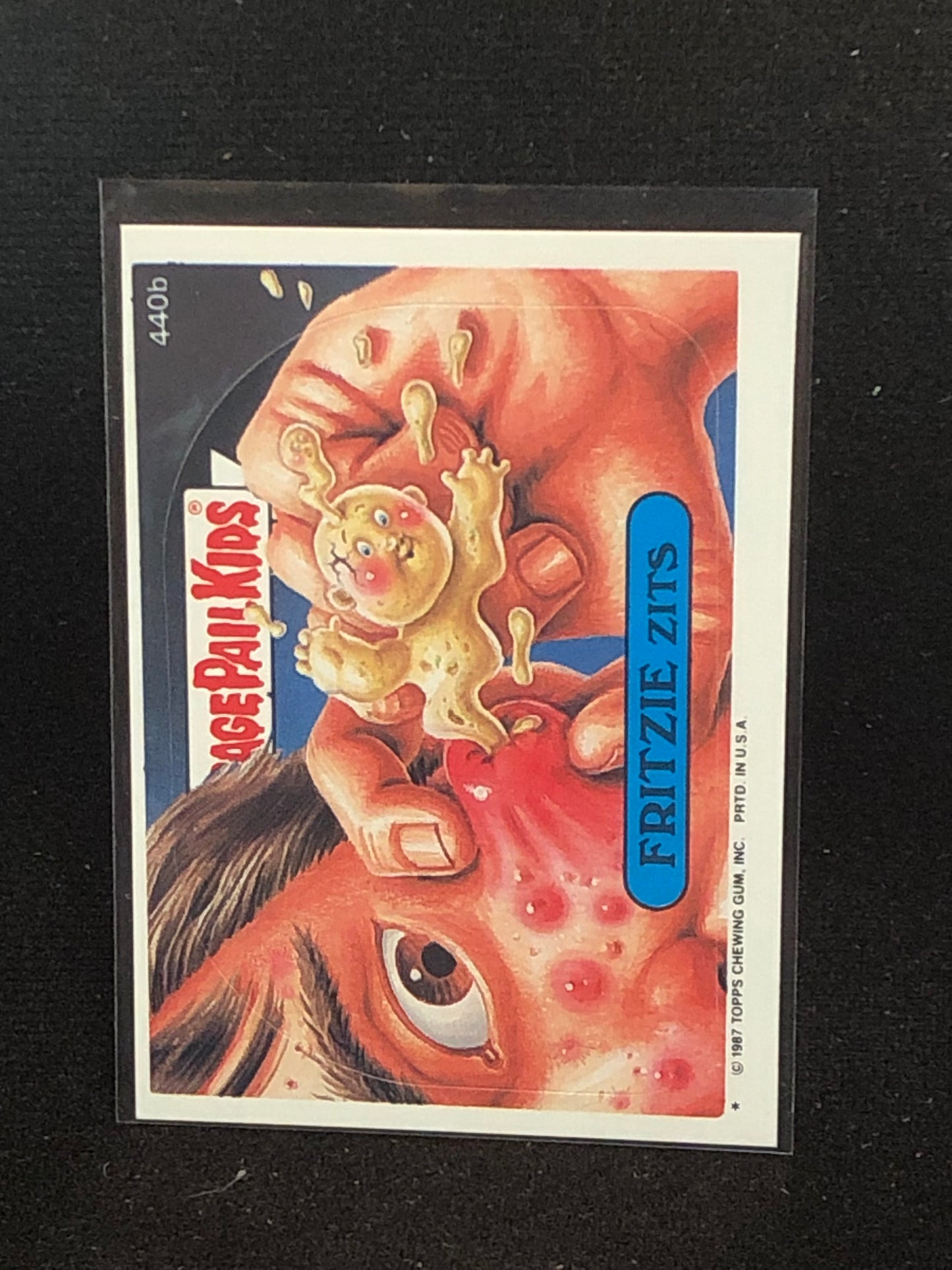 Garbage Pail Kids Original Series 11 (os11) 440b Fritzie Zits