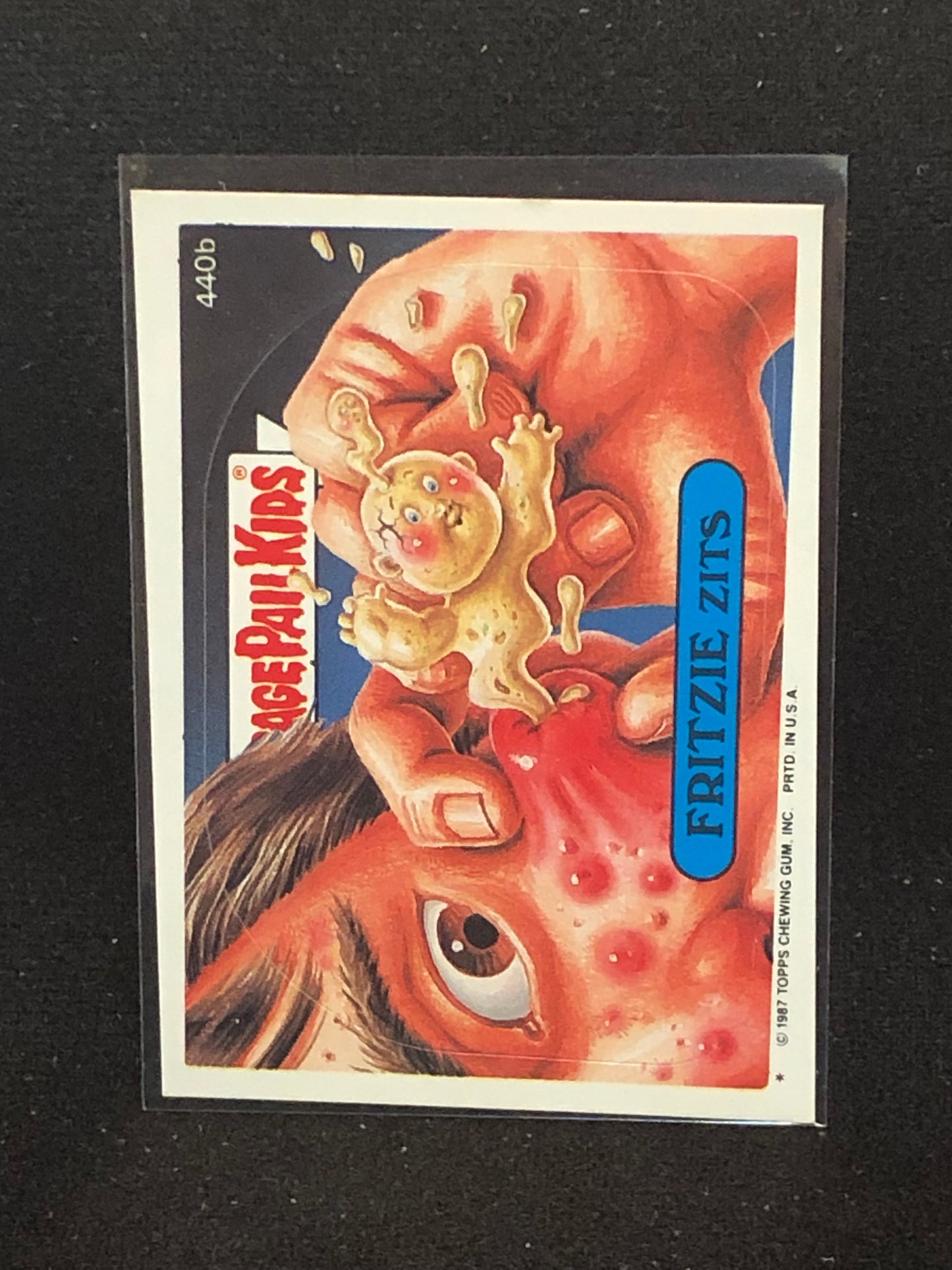 Garbage Pail Kids Original Series 11 (os11) 440b Fritzie Zits