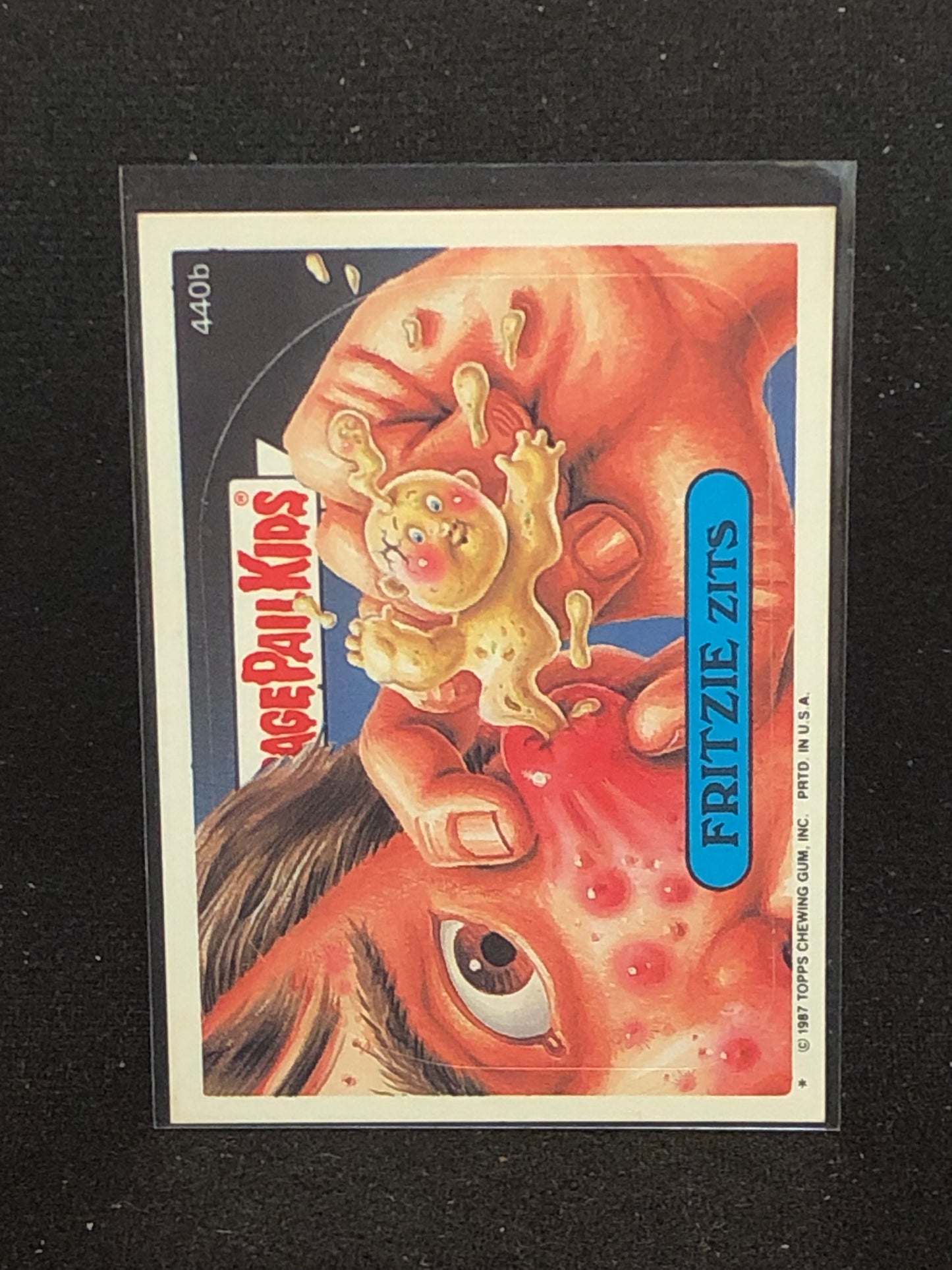 Garbage Pail Kids Original Series 11 (os11) 440b Fritzie Zits