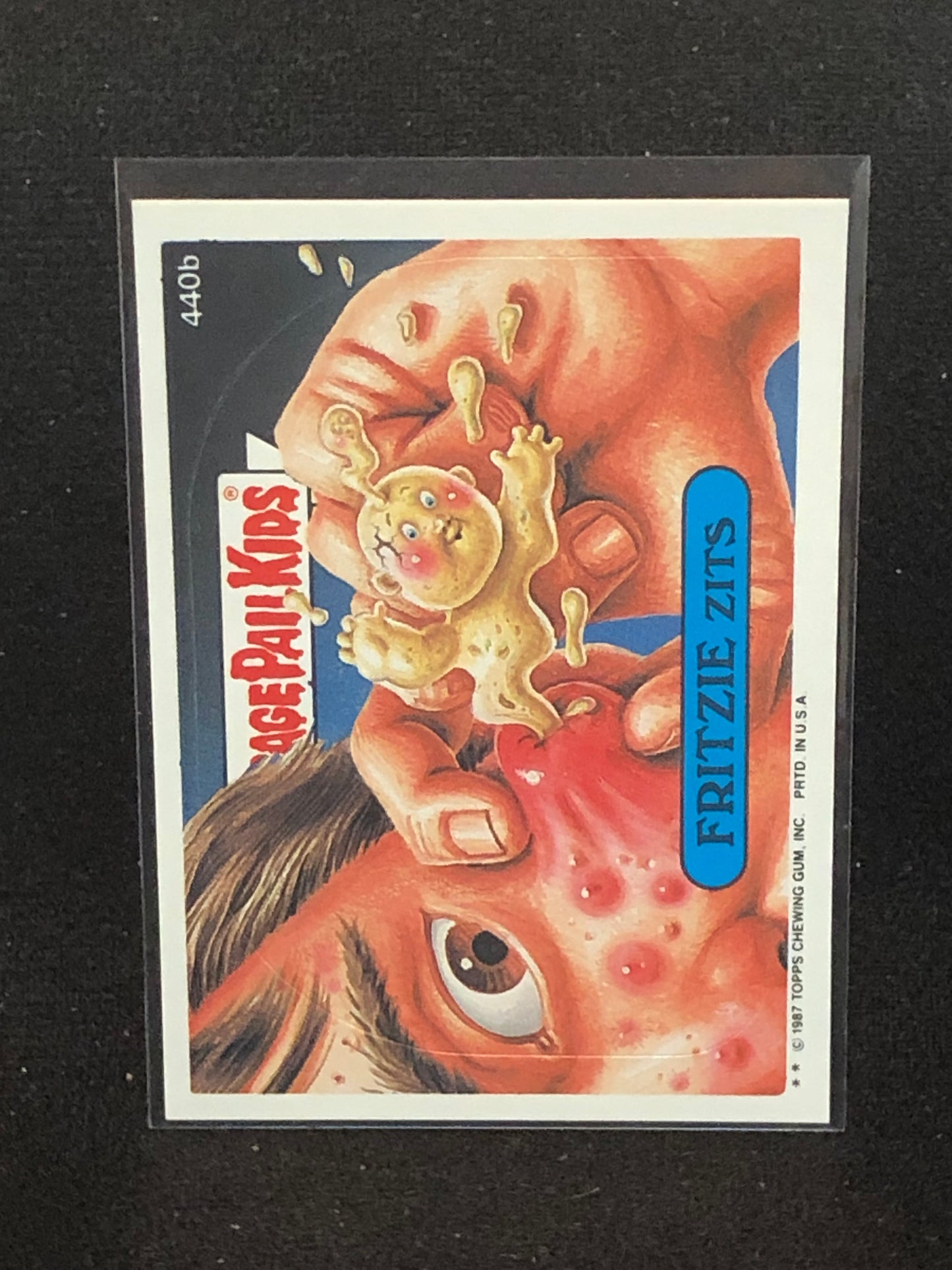 Garbage Pail Kids Original Series 11 (os11) 440b Fritzie Zits