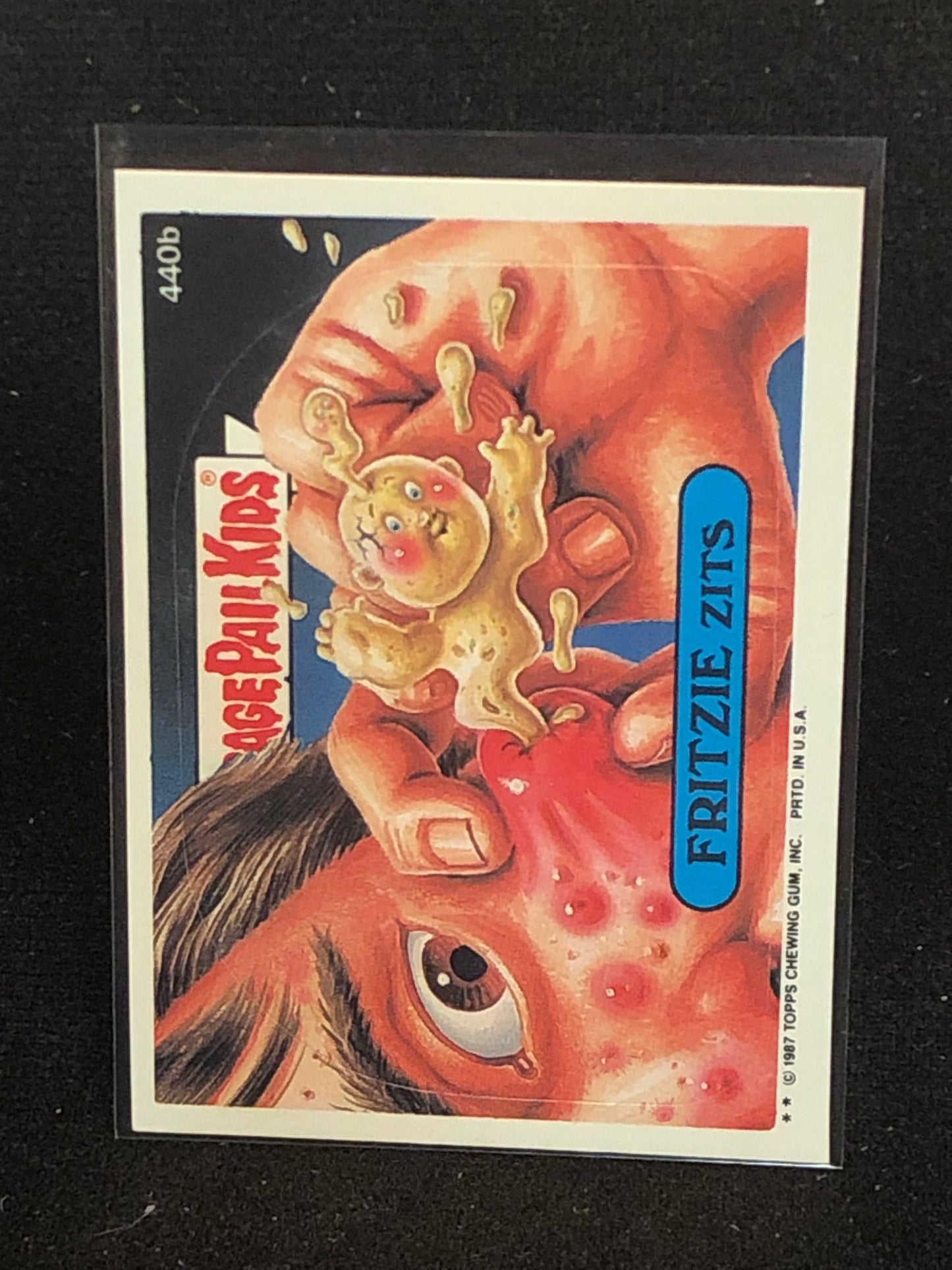 Garbage Pail Kids Original Series 11 (os11) 440b Fritzie Zits