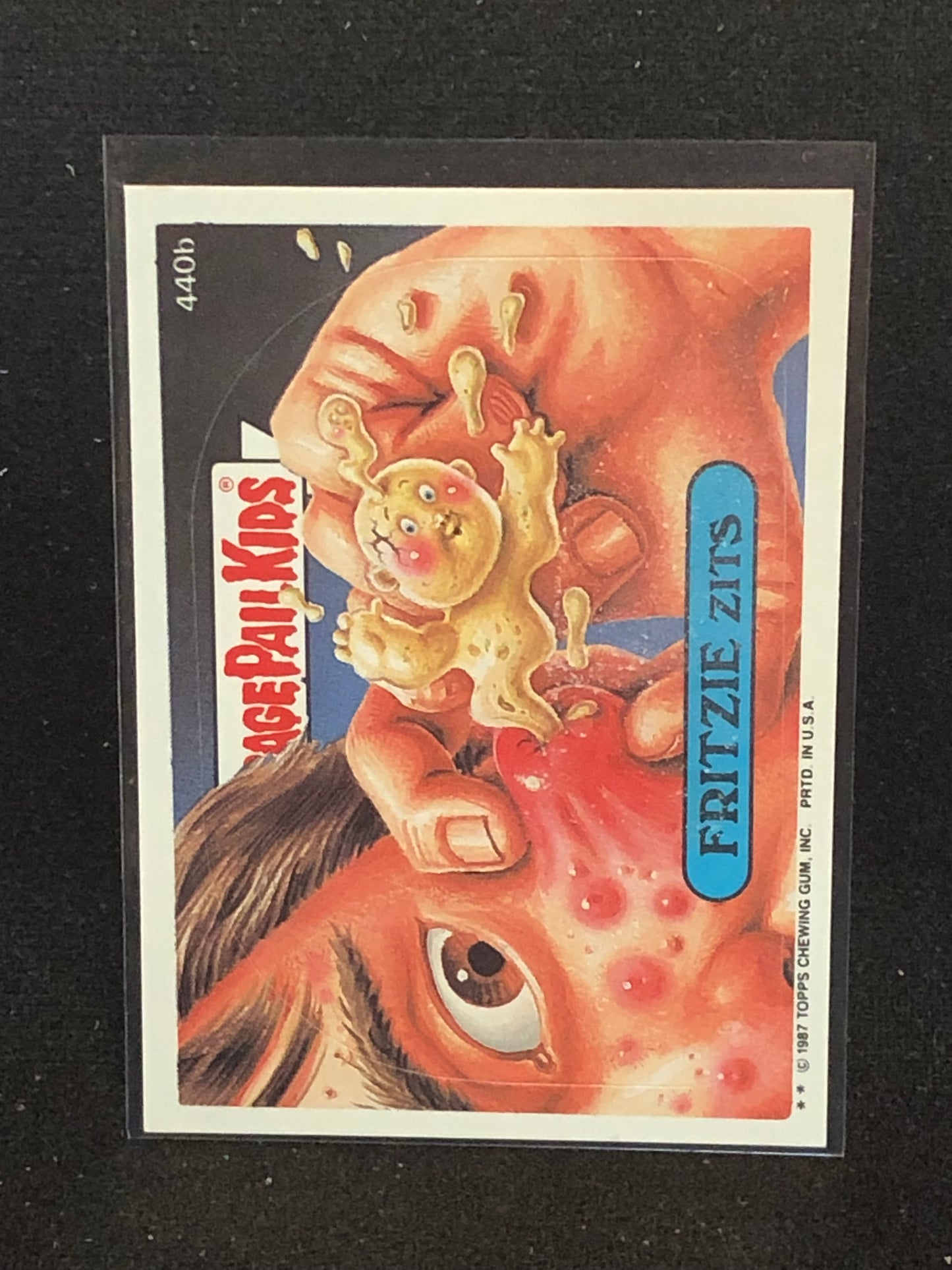 Garbage Pail Kids Original Series 11 (os11) 440b Fritzie Zits