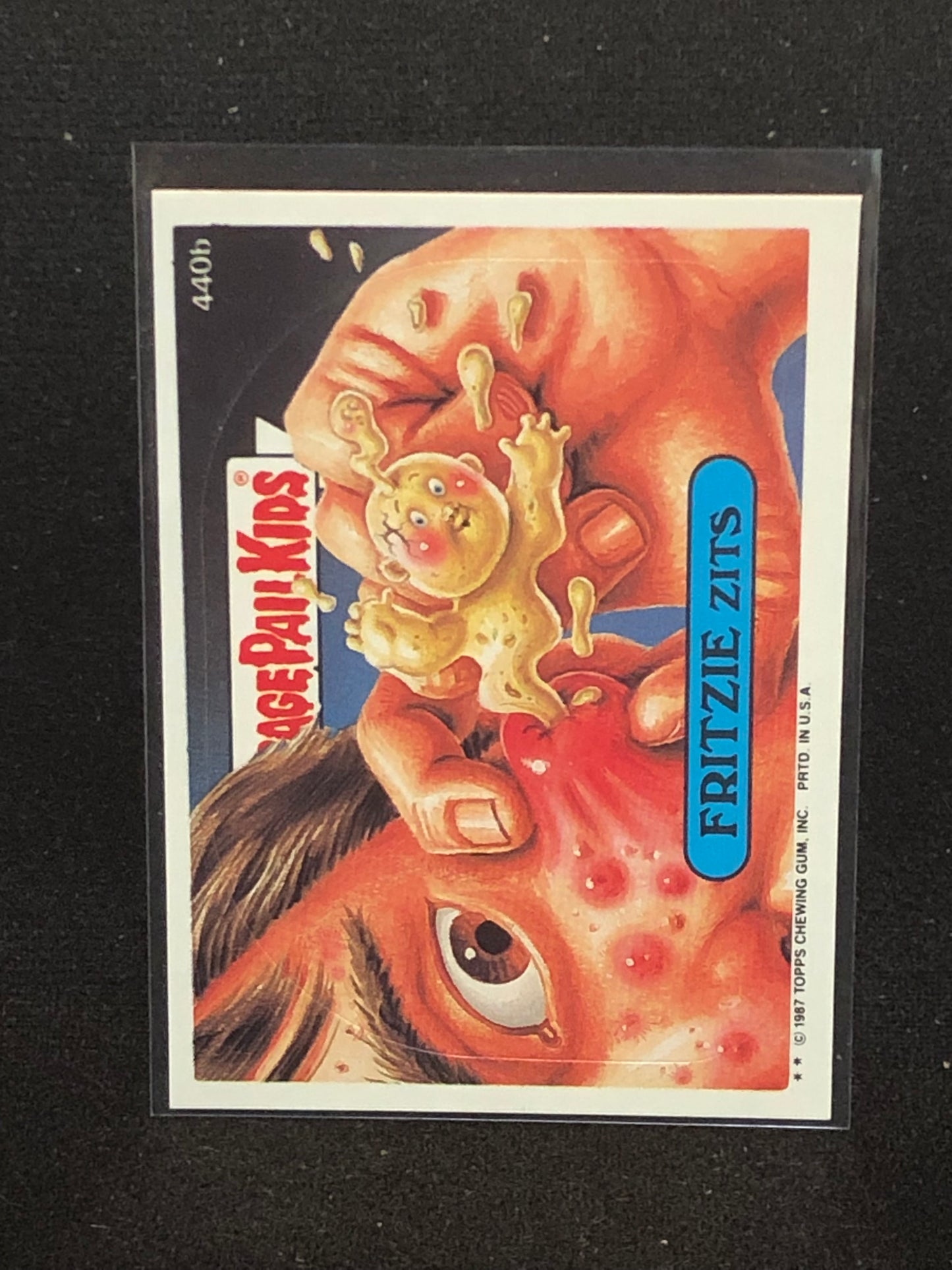 Garbage Pail Kids Original Series 11 (os11) 440b Fritzie Zits