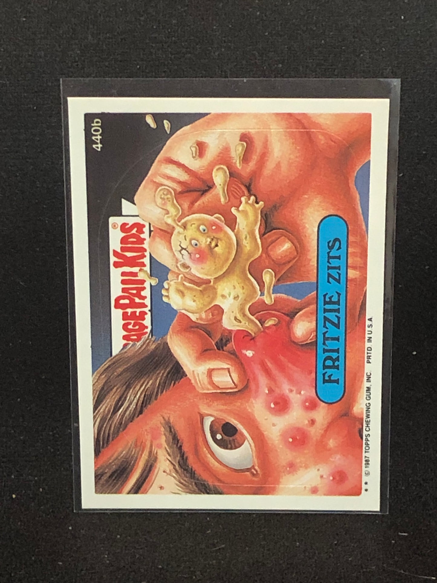 Garbage Pail Kids Original Series 11 (os11) 440b Fritzie Zits