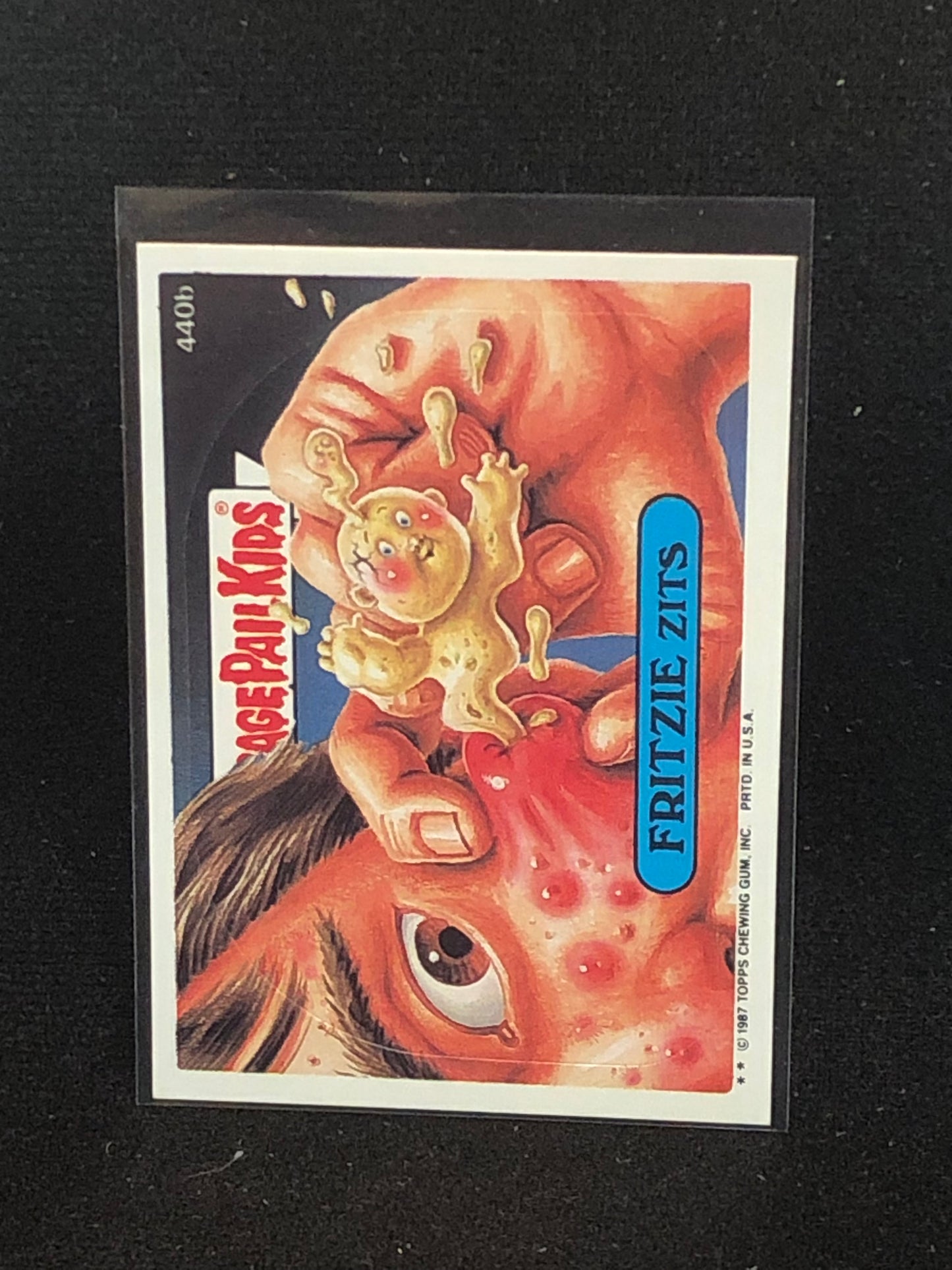 Garbage Pail Kids Original Series 11 (os11) 440b Fritzie Zits