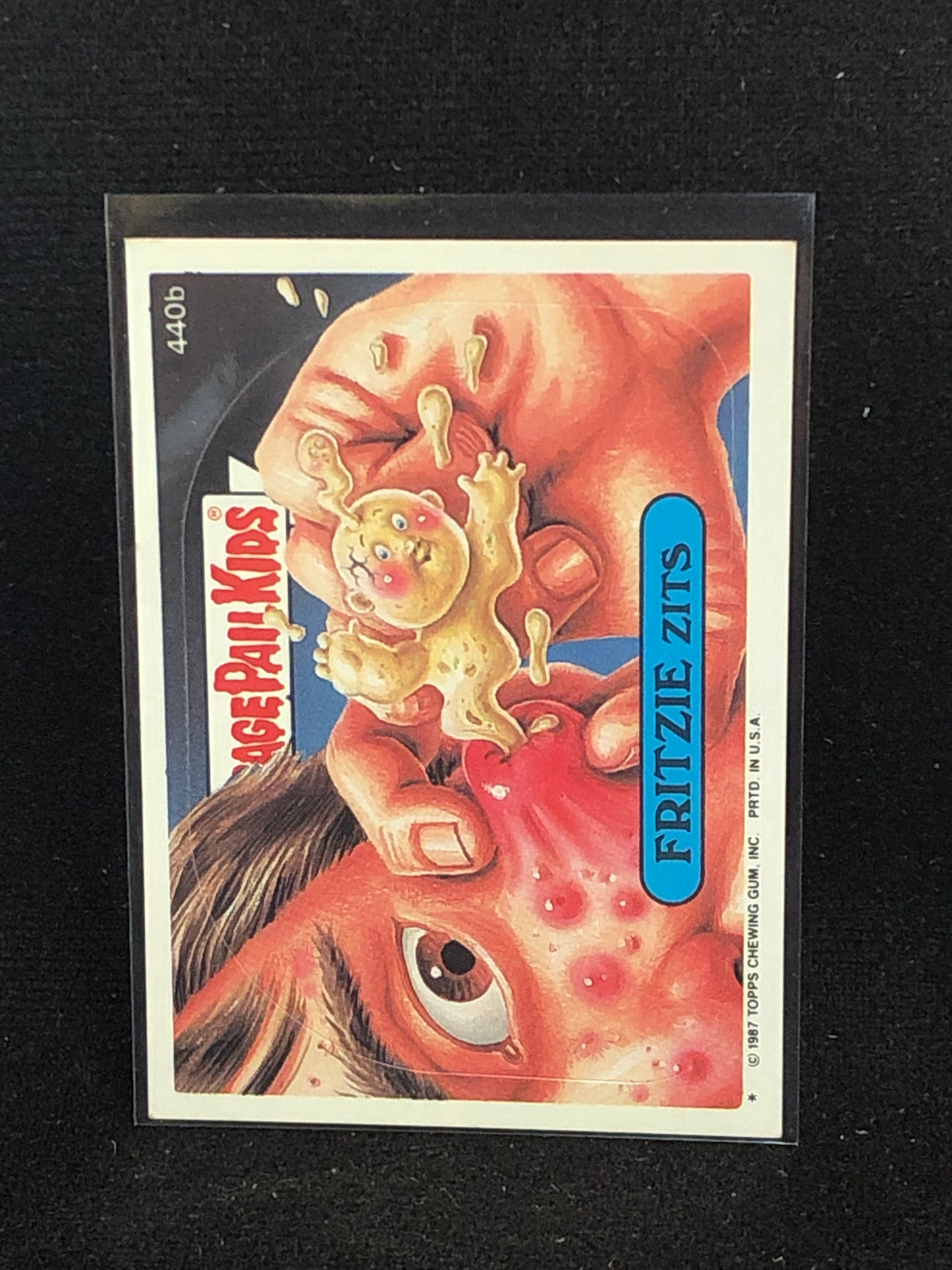 Garbage Pail Kids Original Series 11 (os11) 440b Fritzie Zits