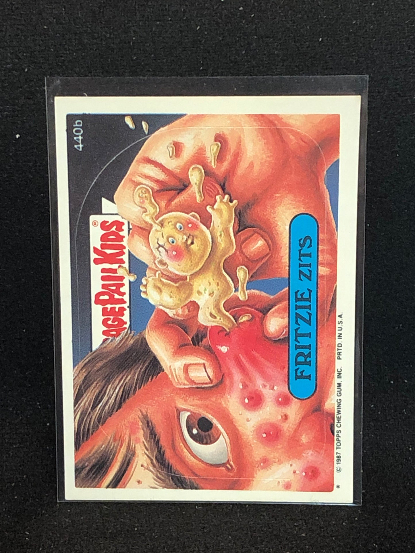Garbage Pail Kids Original Series 11 (os11) 440b Fritzie Zits