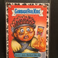 Garbage Pail Kids InterGOOlactic Mayhem U-PICK Black Parallel Singles 51a-100b