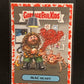 Garbage Pail Kids Oh The Horror-Ible U-PICK Red Parallel Singles