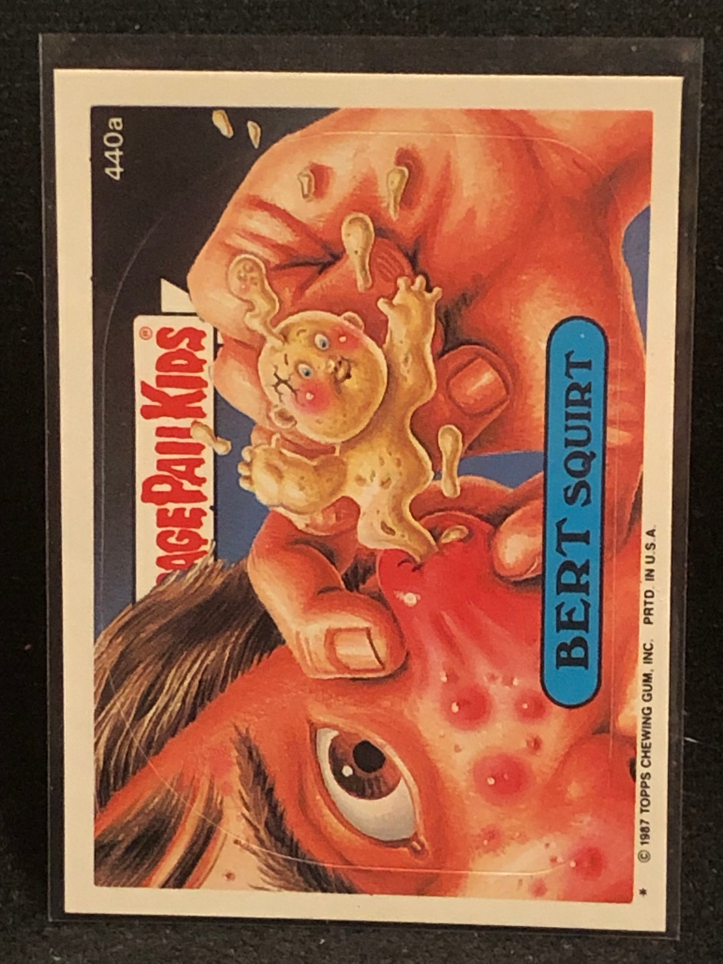 Garbage Pail Kids Original Series 11 (os11) 440a Bert Squirt