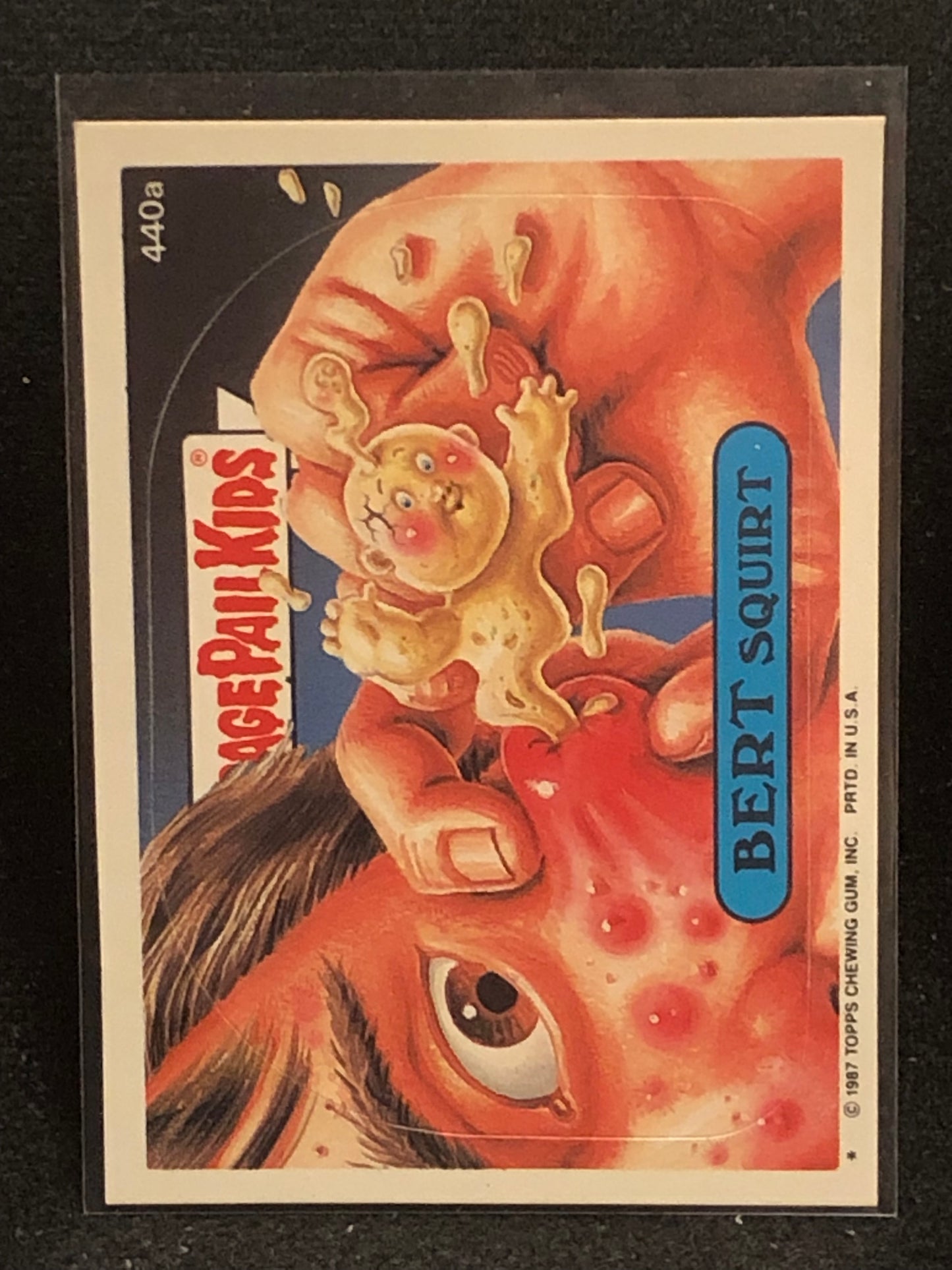Garbage Pail Kids Original Series 11 (os11) 440a Bert Squirt