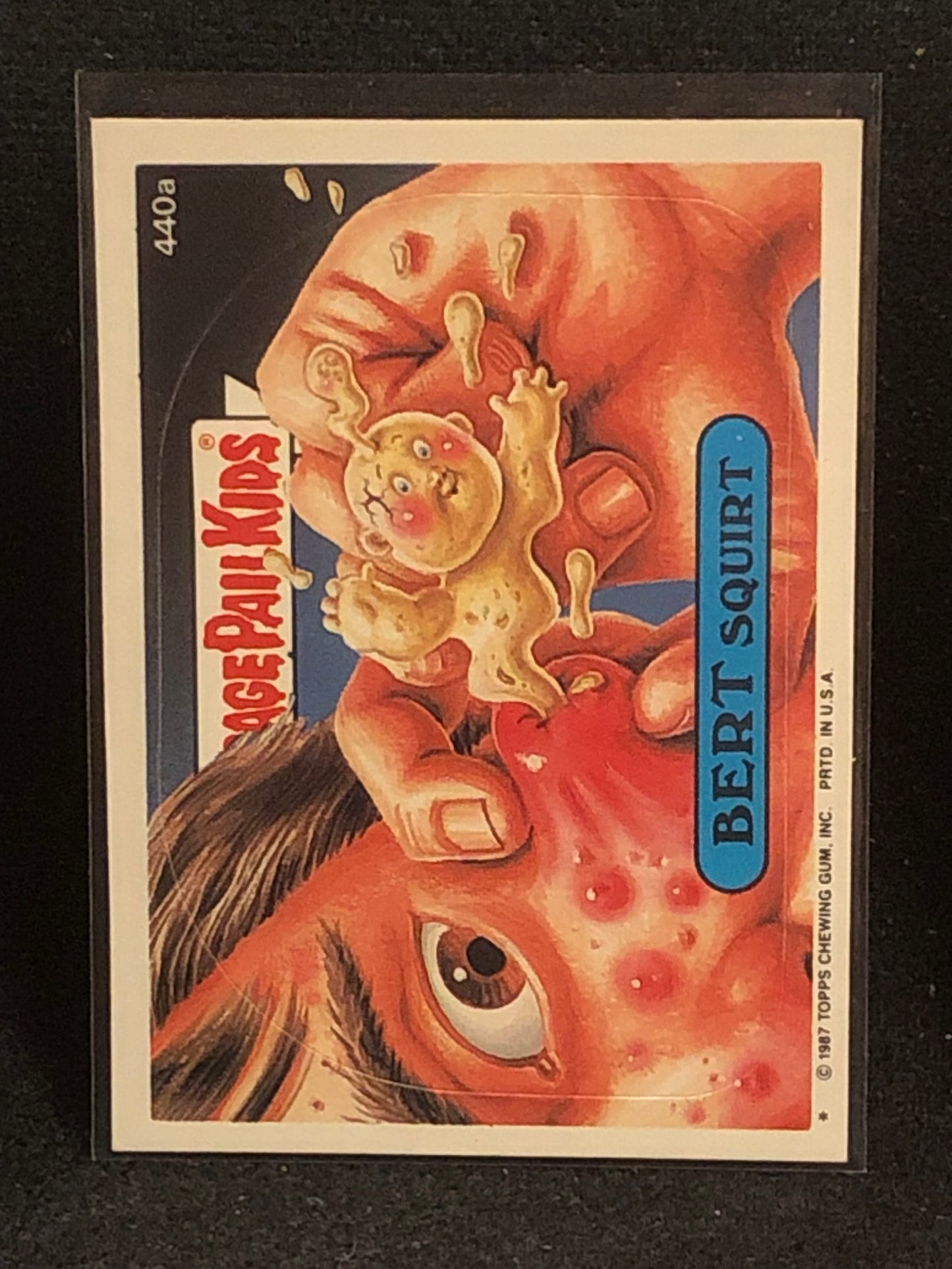 Garbage Pail Kids Original Series 11 (os11) 440a Bert Squirt