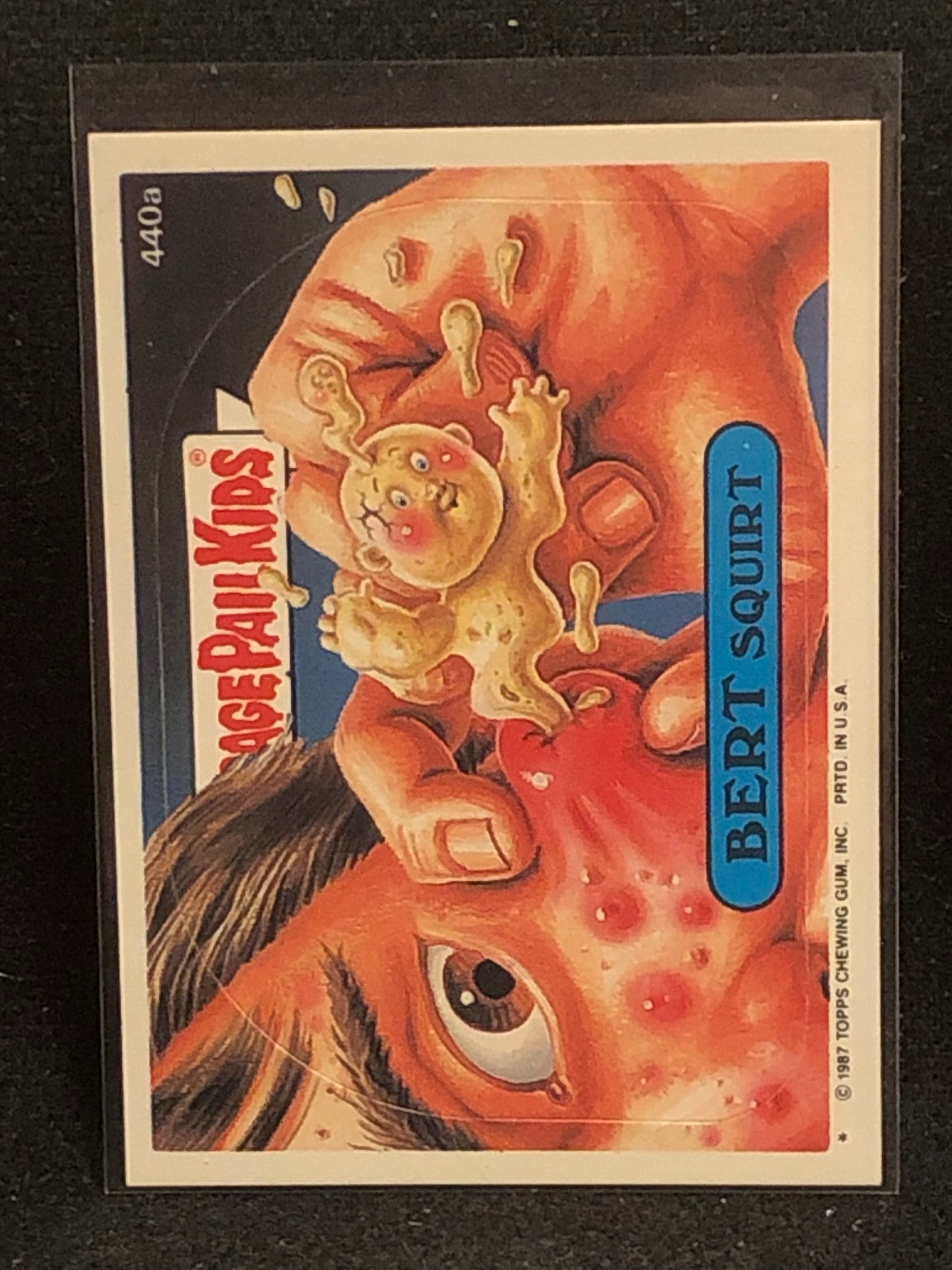 Garbage Pail Kids Original Series 11 (os11) 440a Bert Squirt