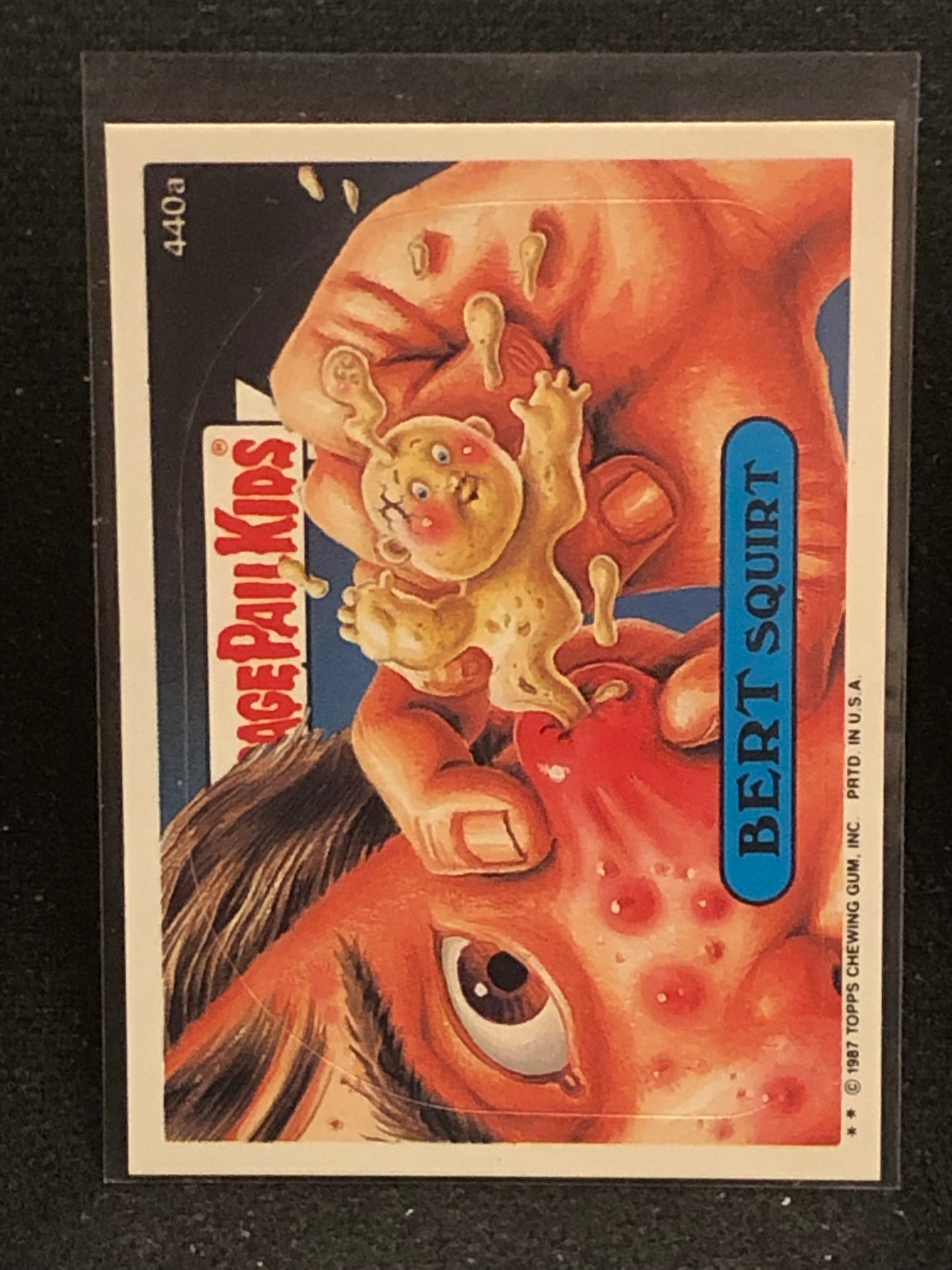 Garbage Pail Kids Original Series 11 (os11) 440a Bert Squirt