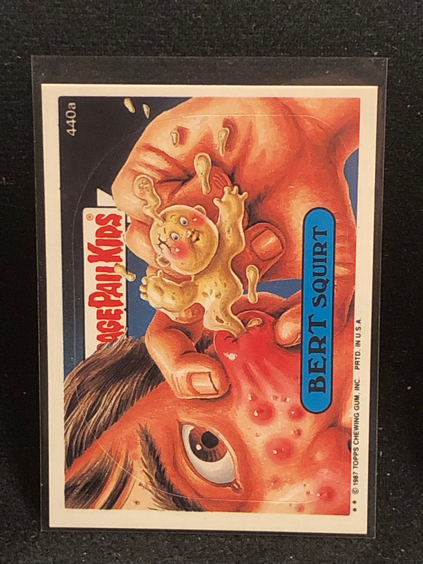 Garbage Pail Kids Original Series 11 (os11) 440a Bert Squirt