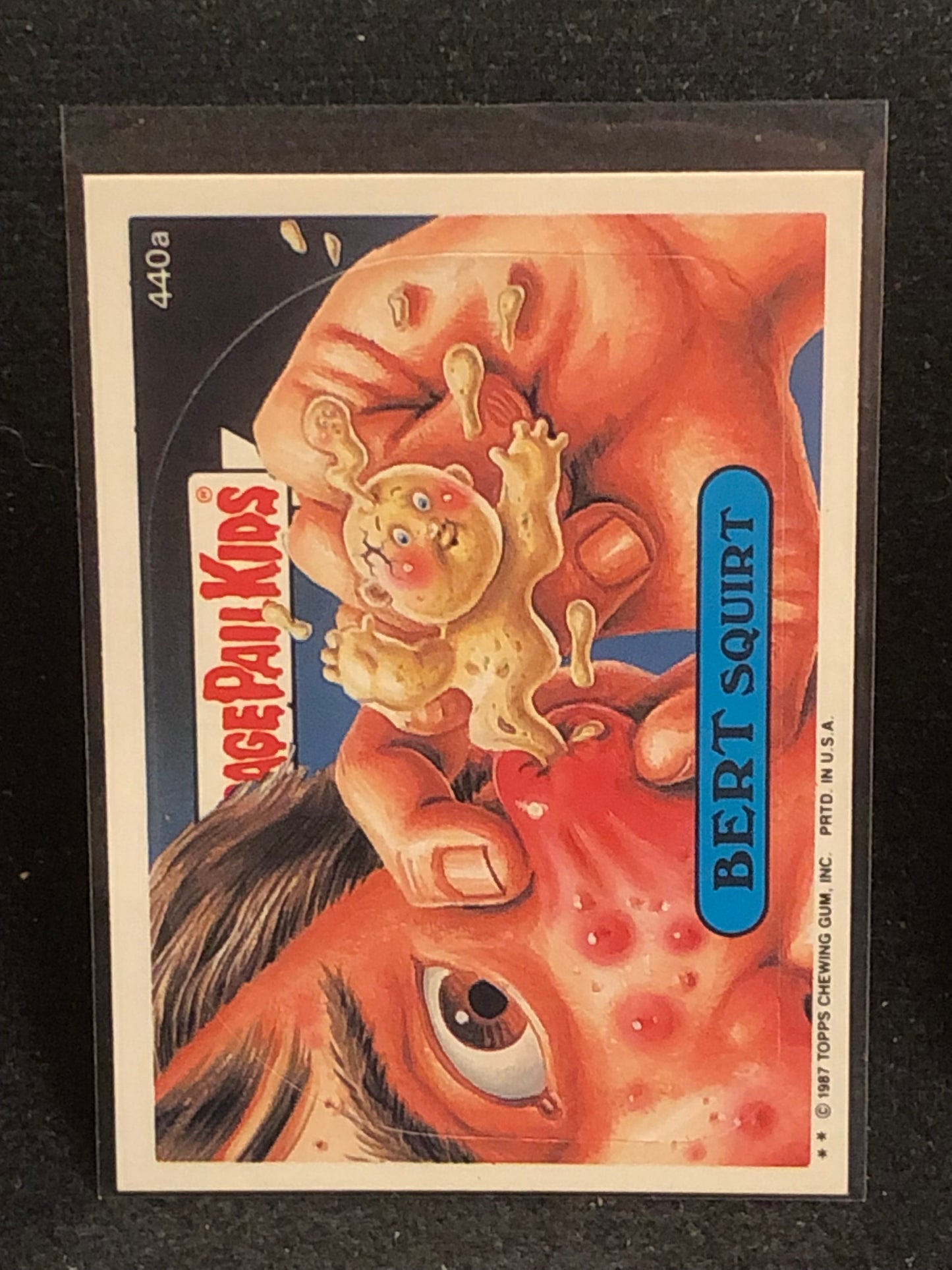 Garbage Pail Kids Original Series 11 (os11) 440a Bert Squirt