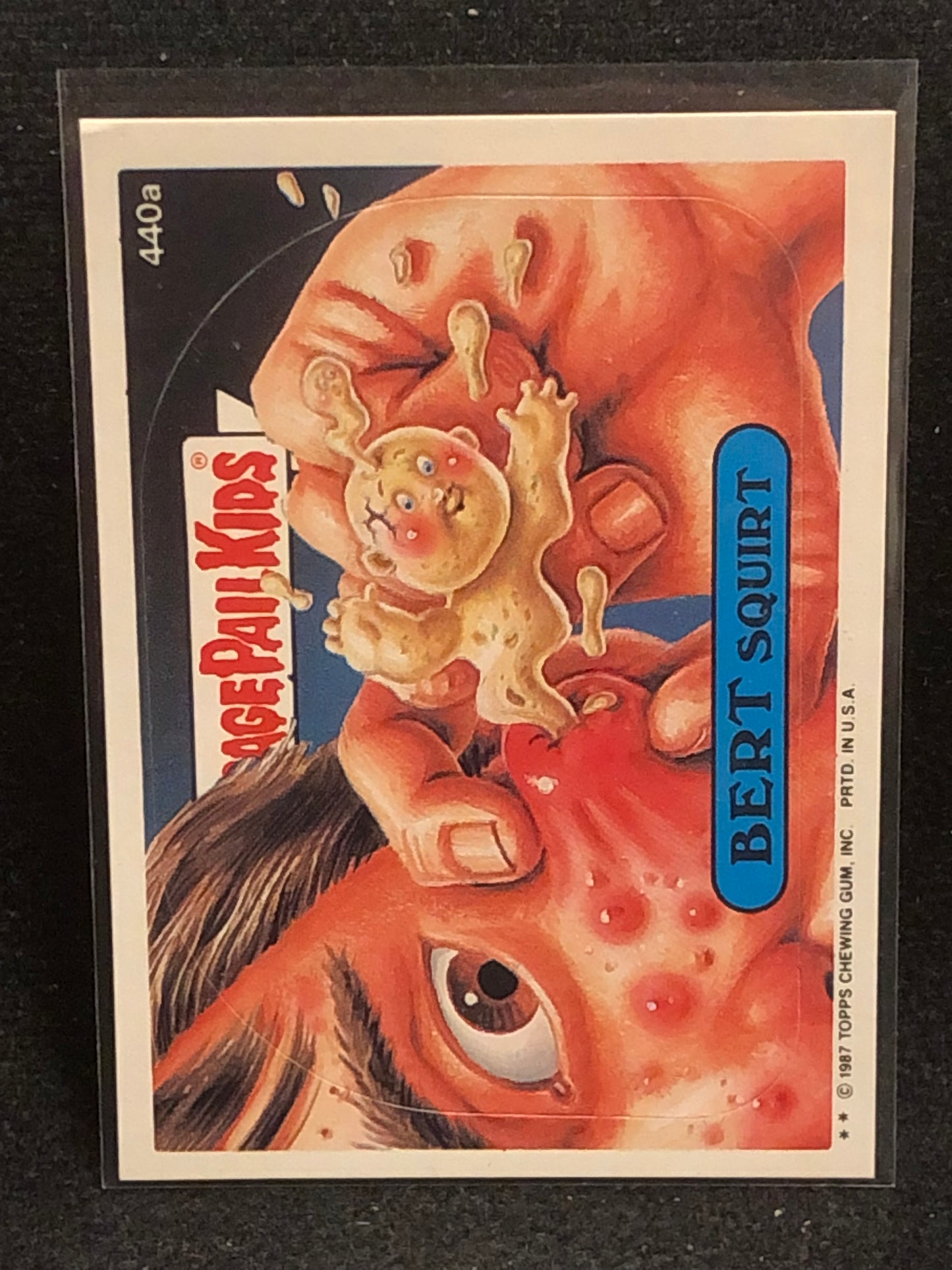 Garbage Pail Kids Original Series 11 (os11) 440a Bert Squirt