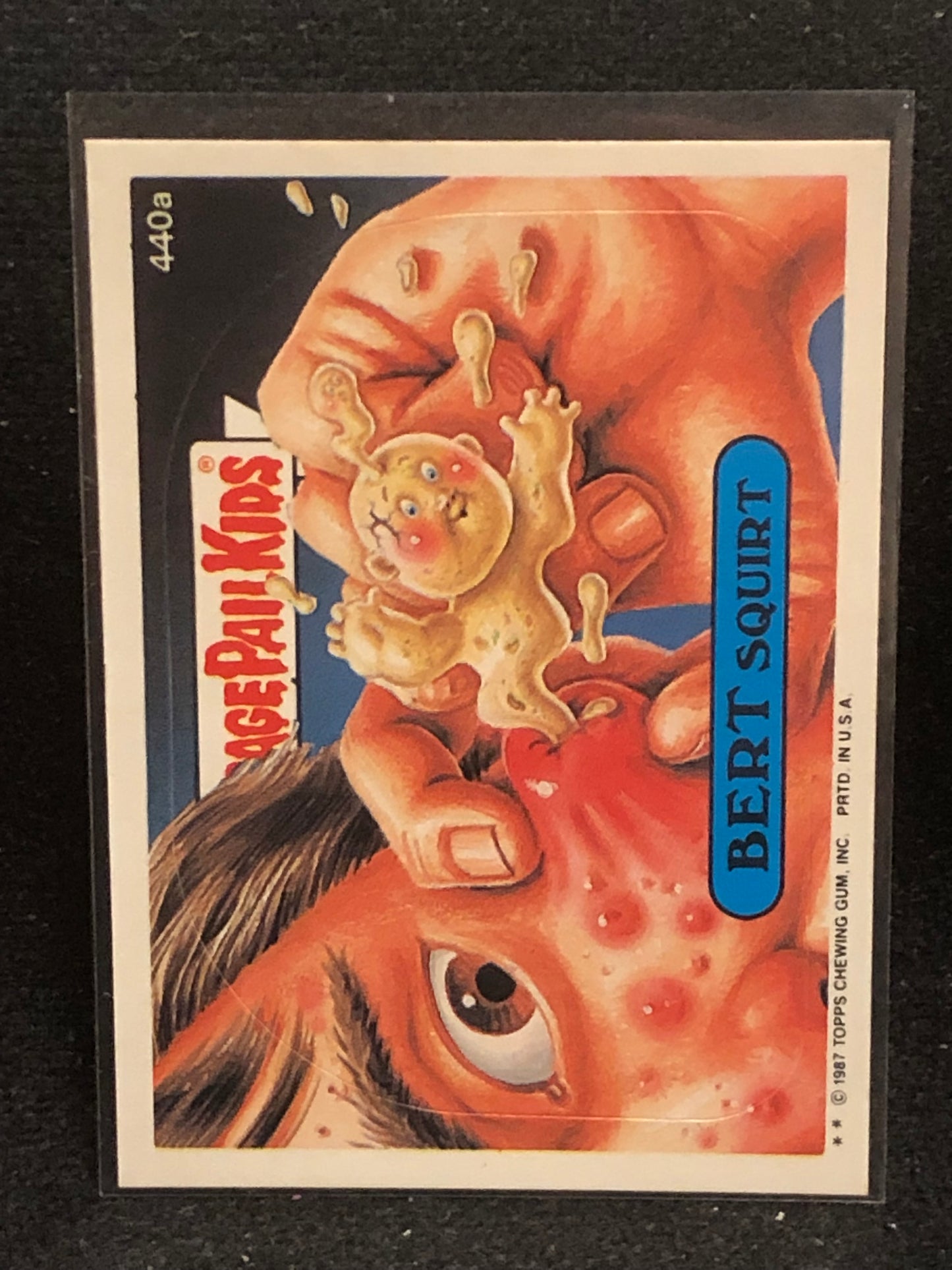 Garbage Pail Kids Original Series 11 (os11) 440a Bert Squirt