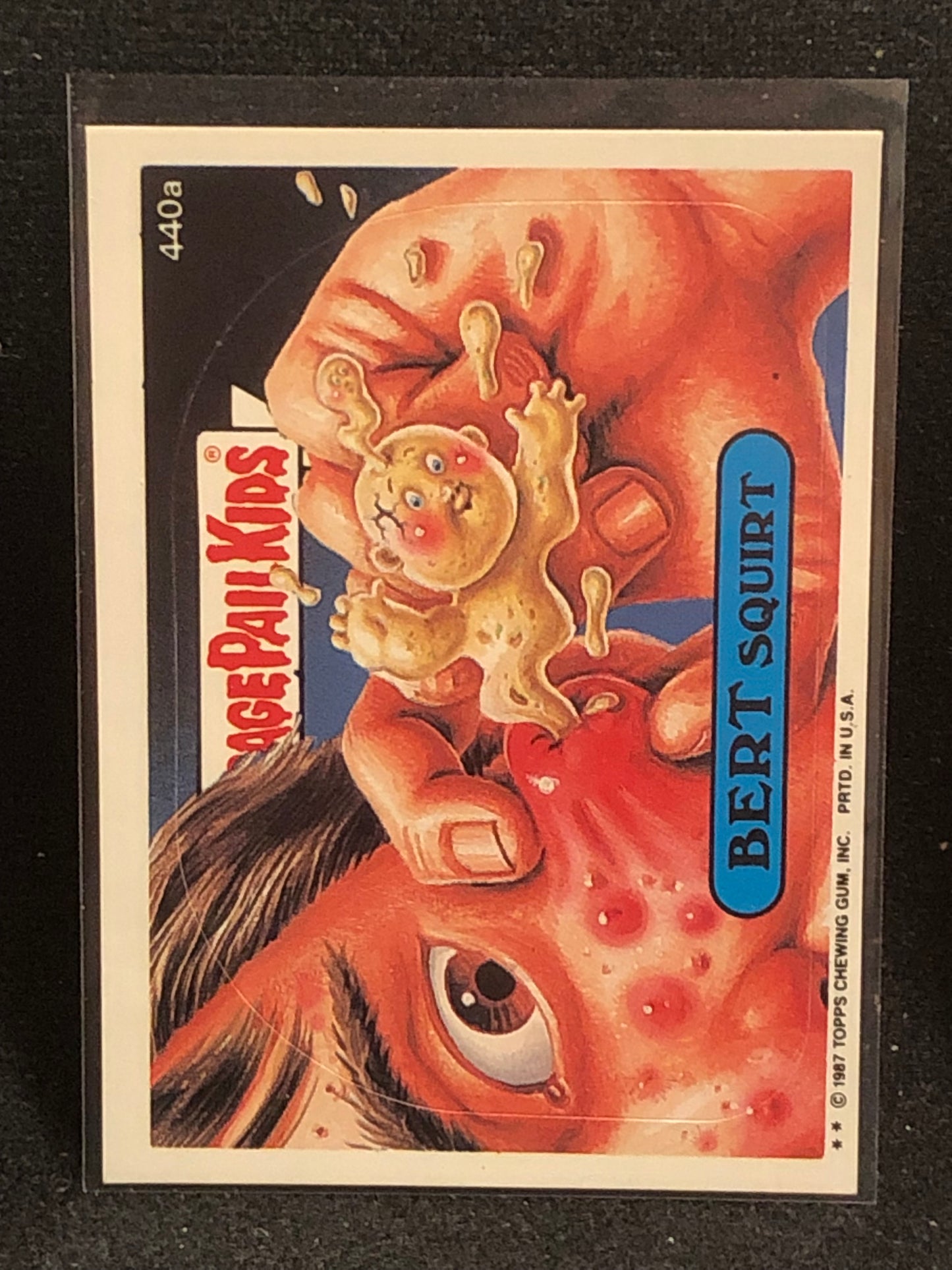 Garbage Pail Kids Original Series 11 (os11) 440a Bert Squirt