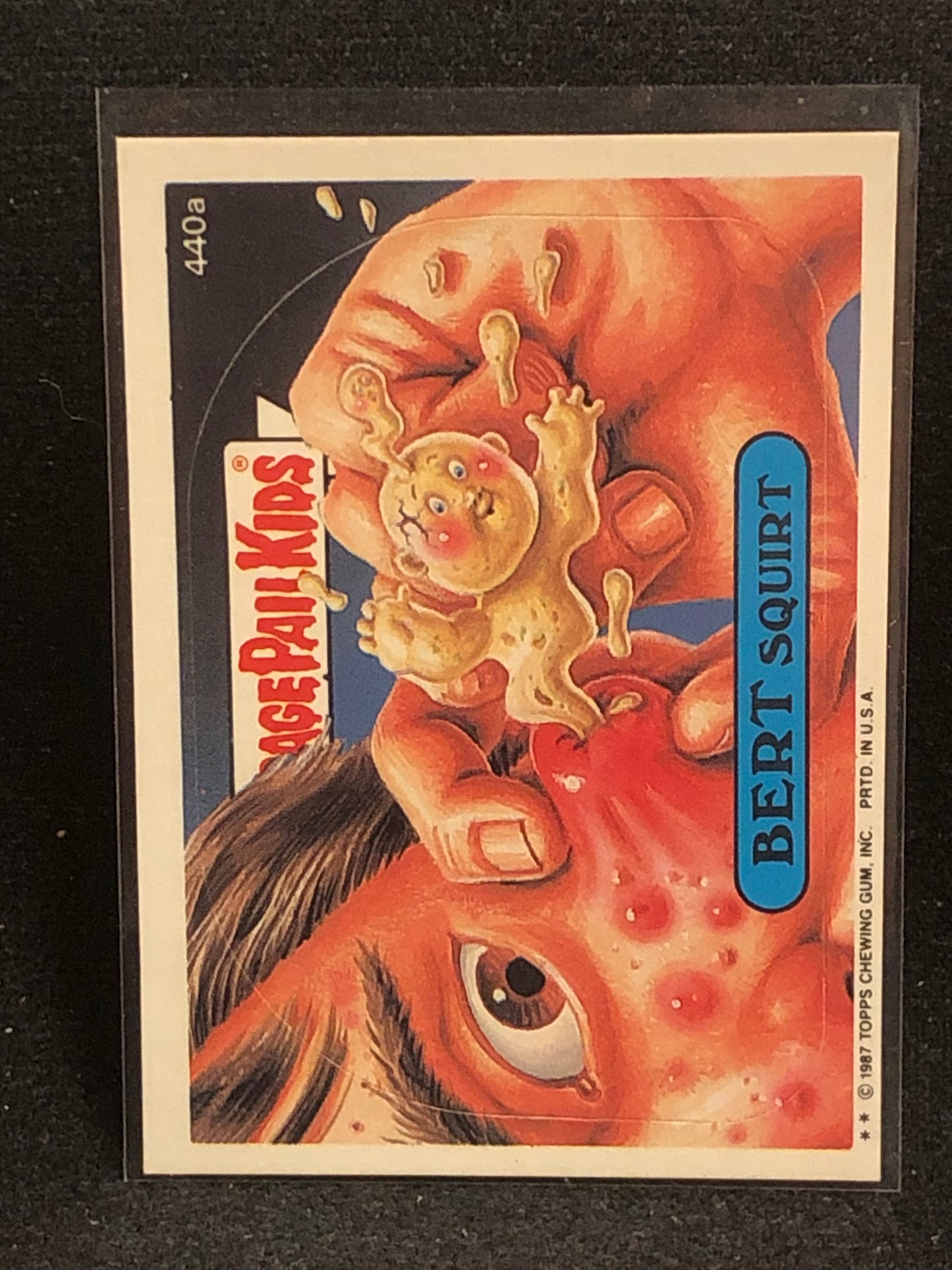 Garbage Pail Kids Original Series 11 (os11) 440a Bert Squirt