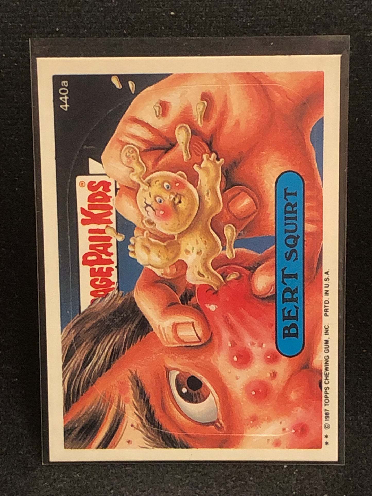Garbage Pail Kids Original Series 11 (os11) 440a Bert Squirt