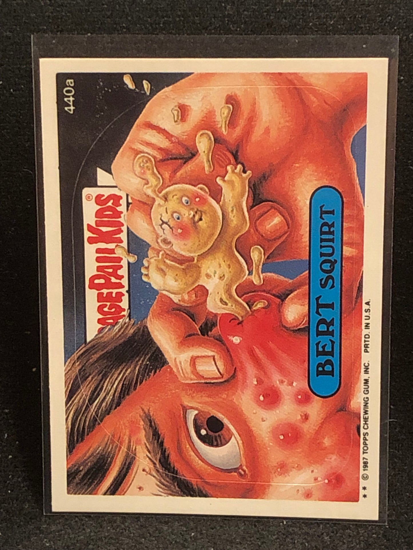 Garbage Pail Kids Original Series 11 (os11) 440a Bert Squirt