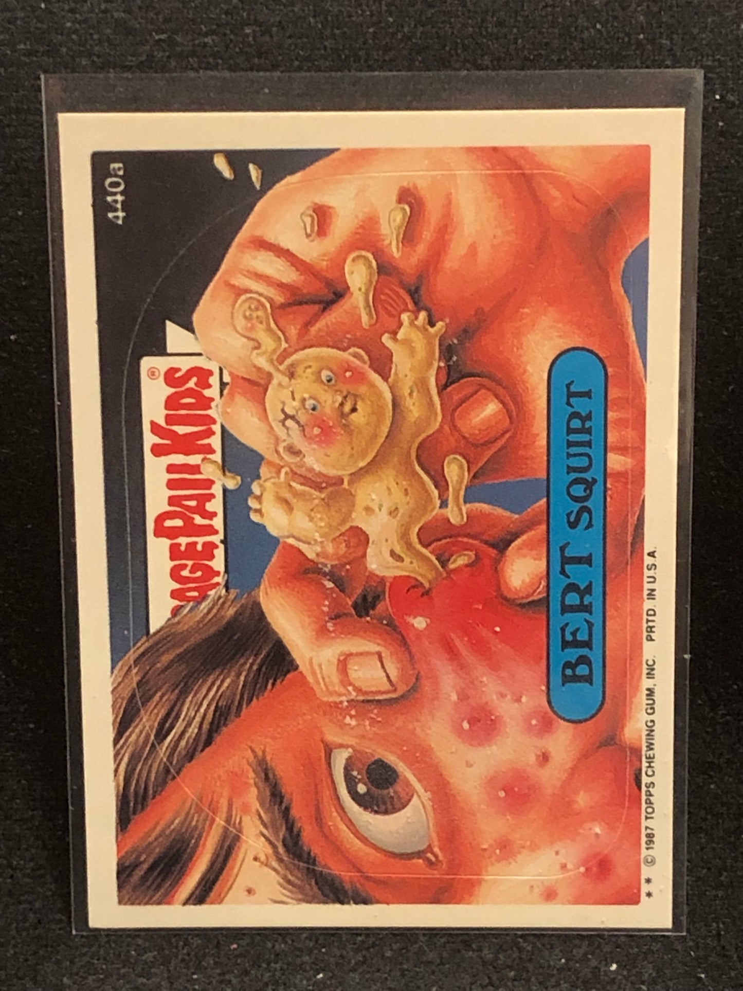 Garbage Pail Kids Original Series 11 (os11) 440a Bert Squirt