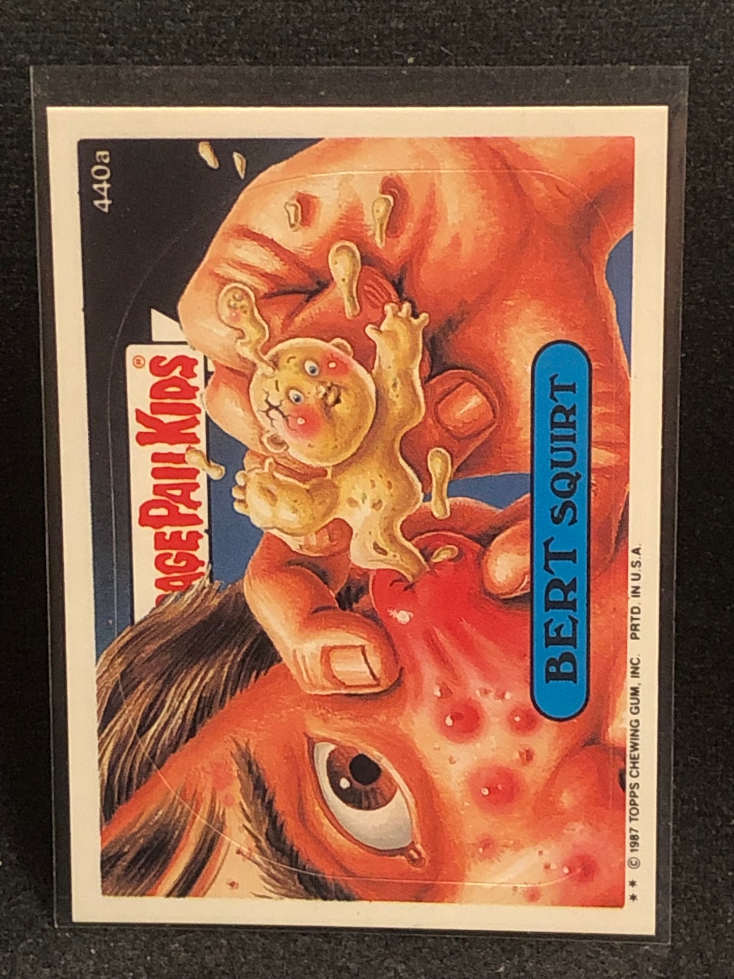 Garbage Pail Kids Original Series 11 (os11) 440a Bert Squirt