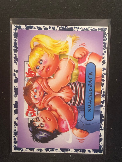 Garbage Pail Kids We Hate The 80's U-PICK Bruised Singles