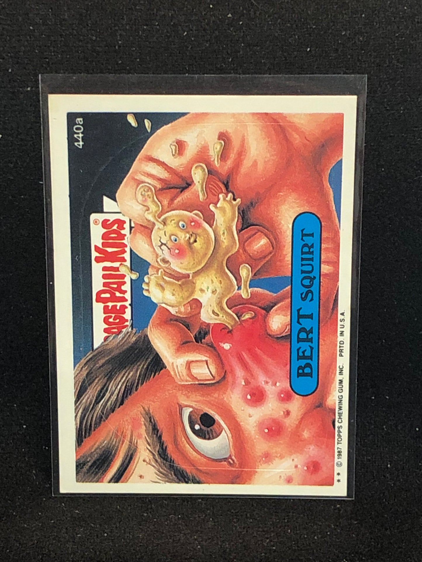 Garbage Pail Kids Original Series 11 (os11) 440a Bert Squirt
