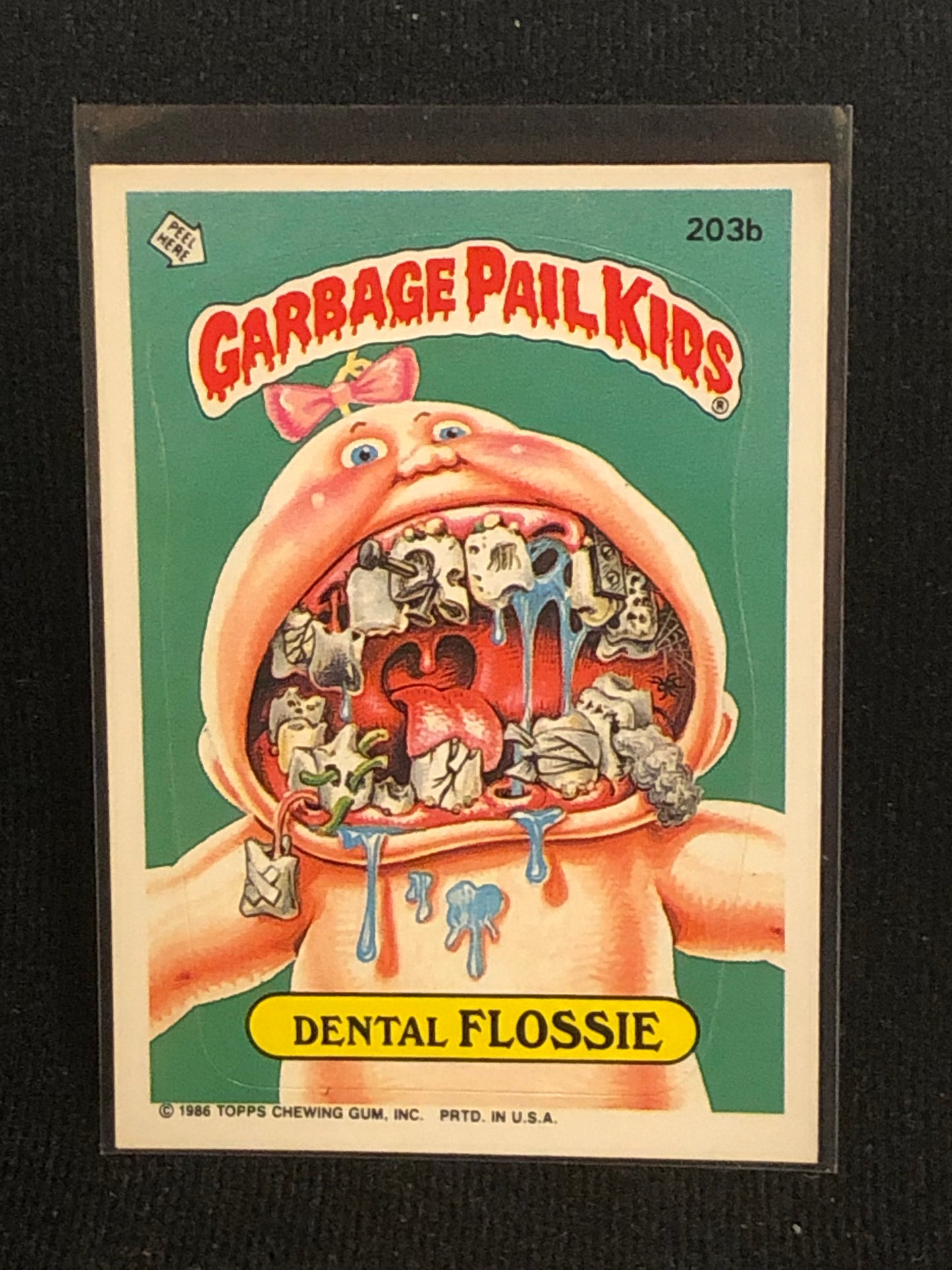 Garbage Pail Kids Original Series 5 (os5) 203b Dental Flossie