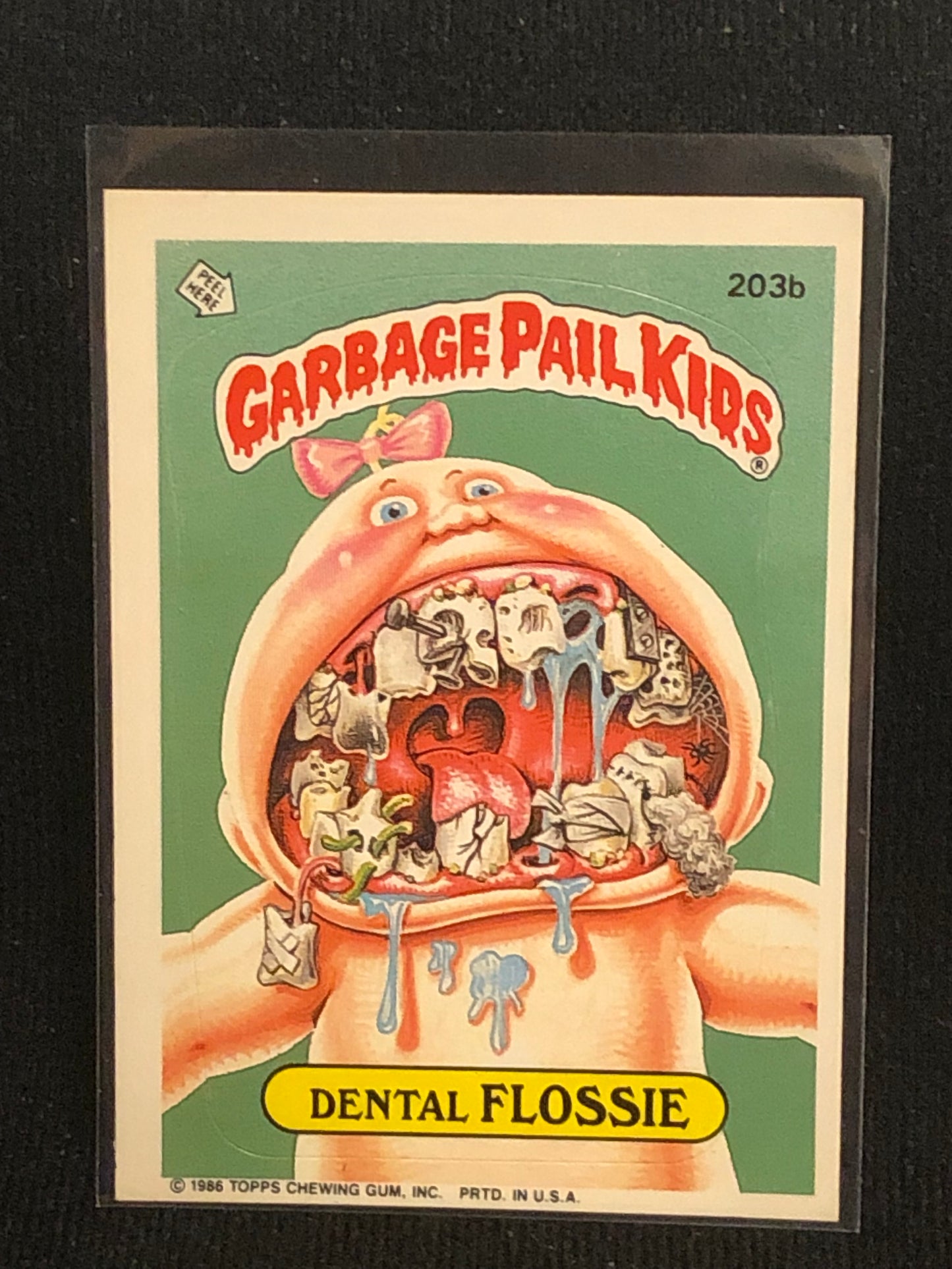 Garbage Pail Kids Original Series 5 (os5) 203b Dental Flossie