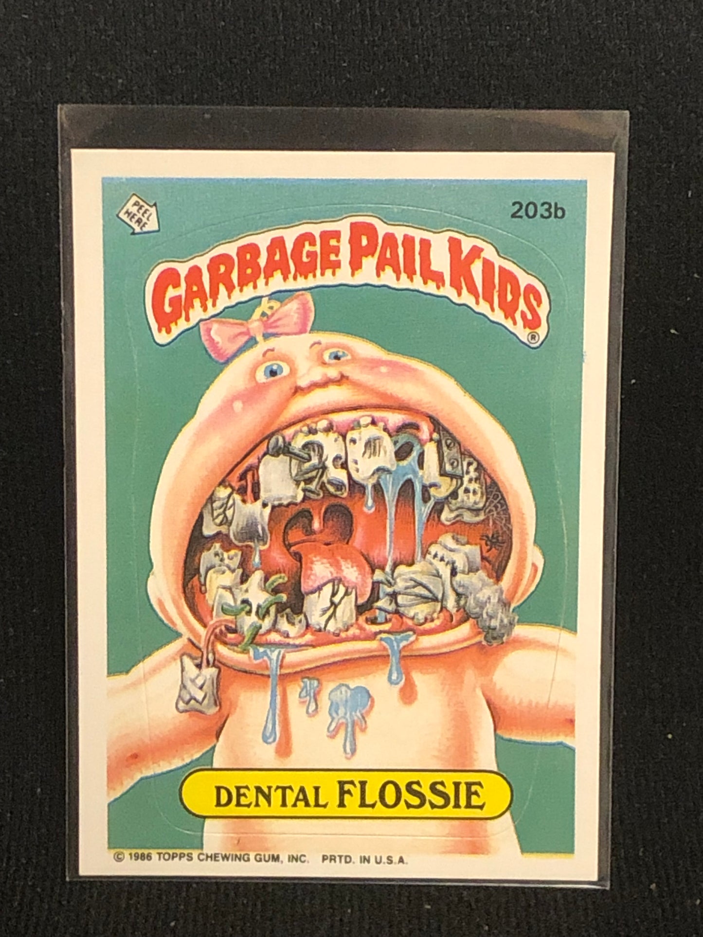 Garbage Pail Kids Original Series 5 (os5) 203b Dental Flossie