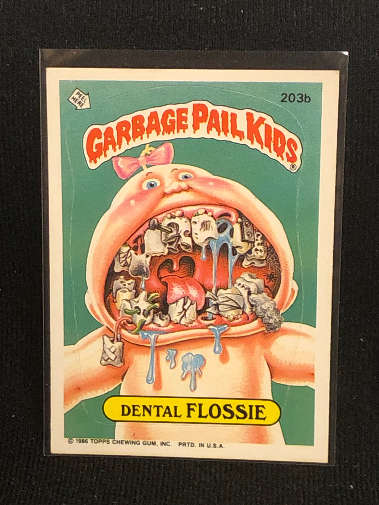 Garbage Pail Kids Original Series 5 (os5) 203b Dental Flossie