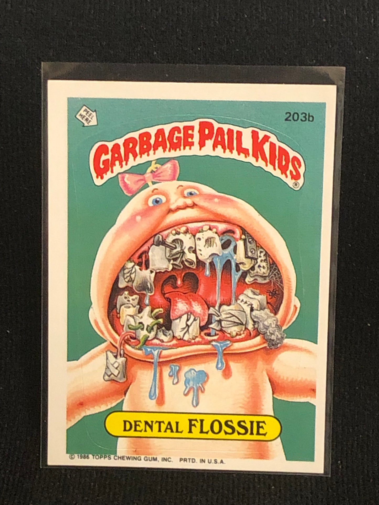 Garbage Pail Kids Original Series 5 (os5) 203b Dental Flossie